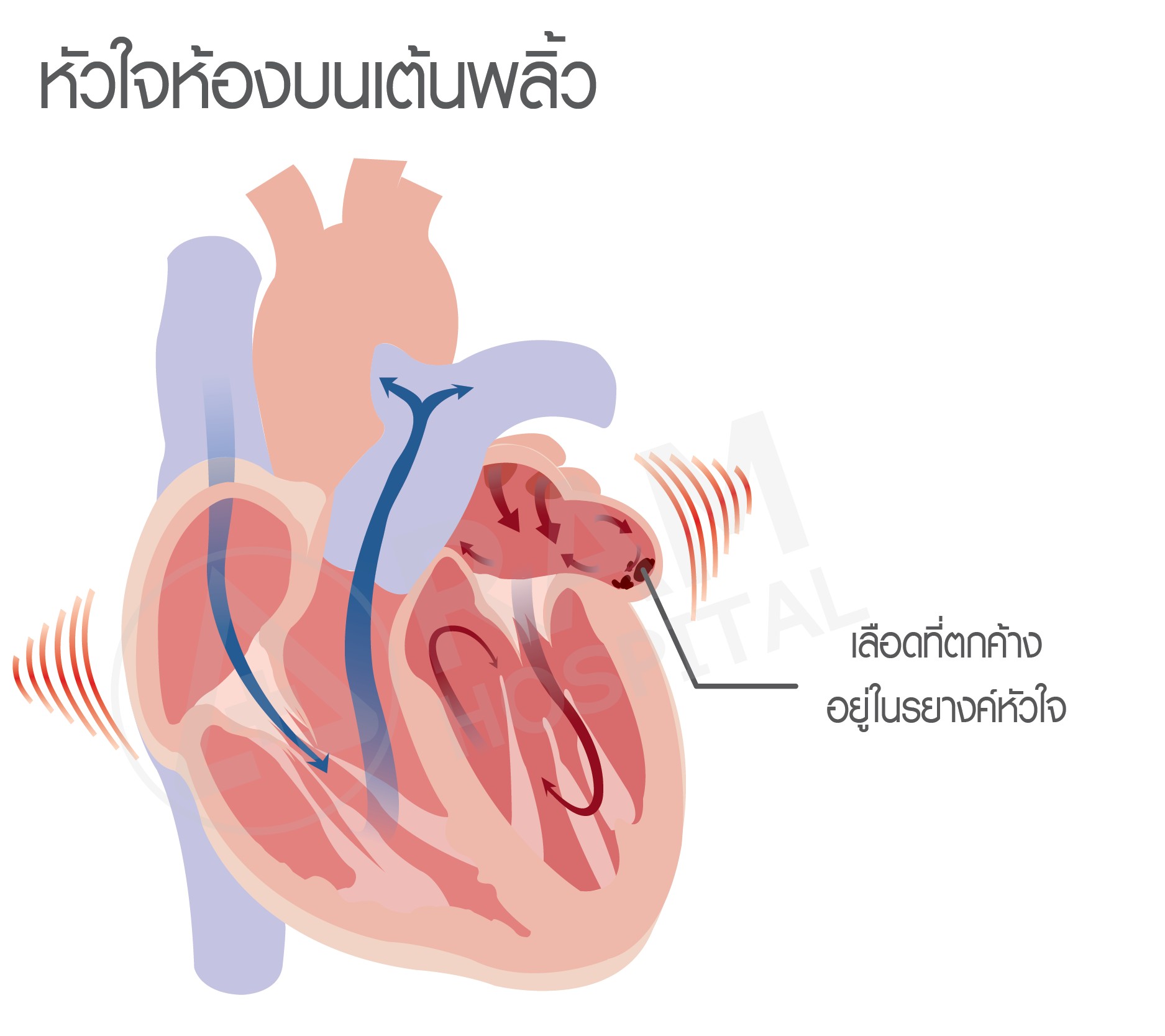 หัวใจเต้นพลิ้ว