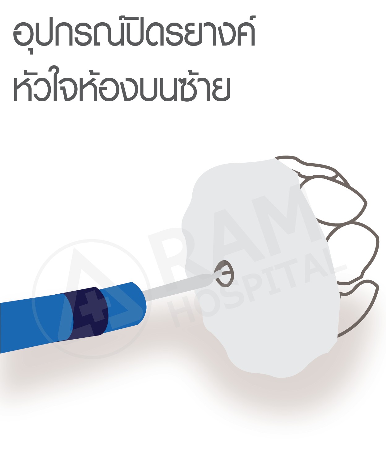 หัวใจเต้นพลิ้ว