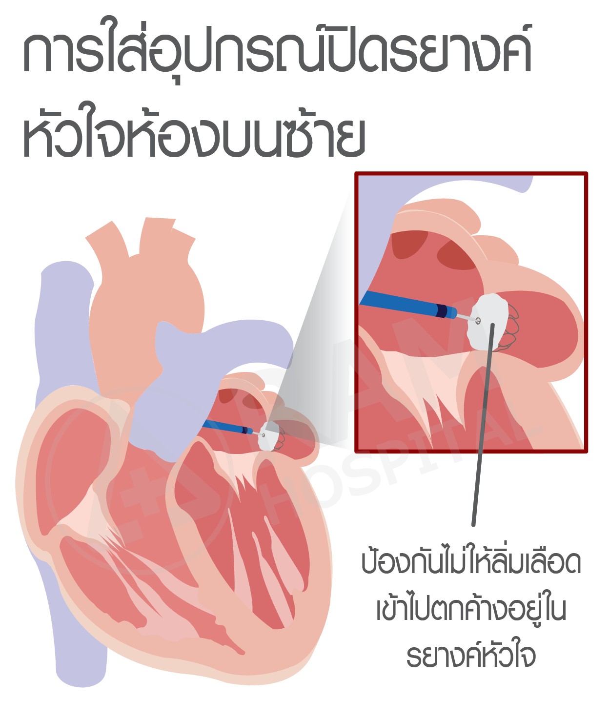 หัวใจเต้นพลิ้ว