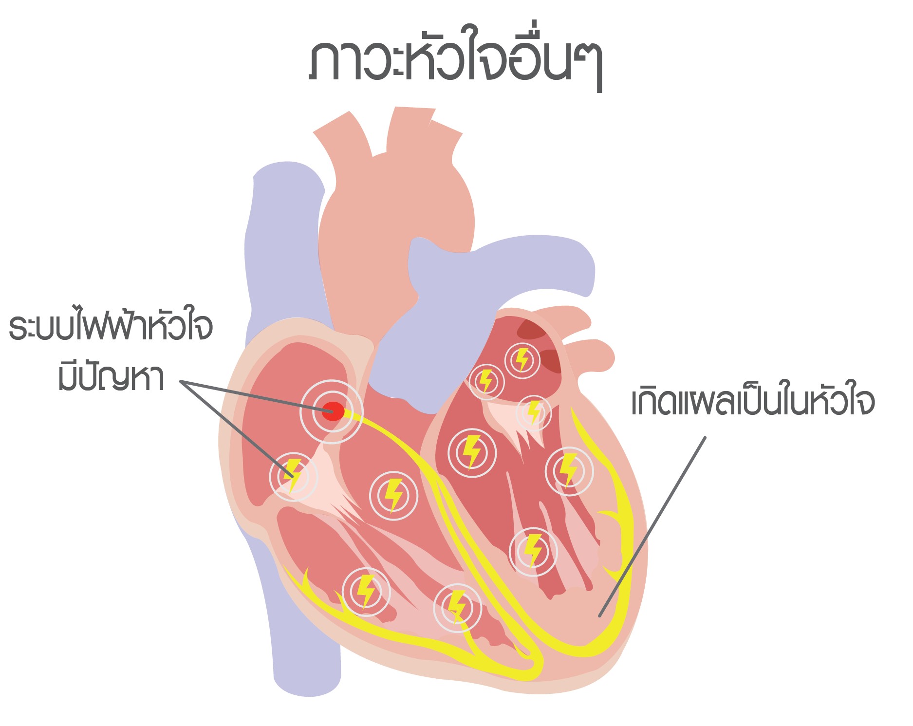 หัวใจเต้นพลิ้ว
