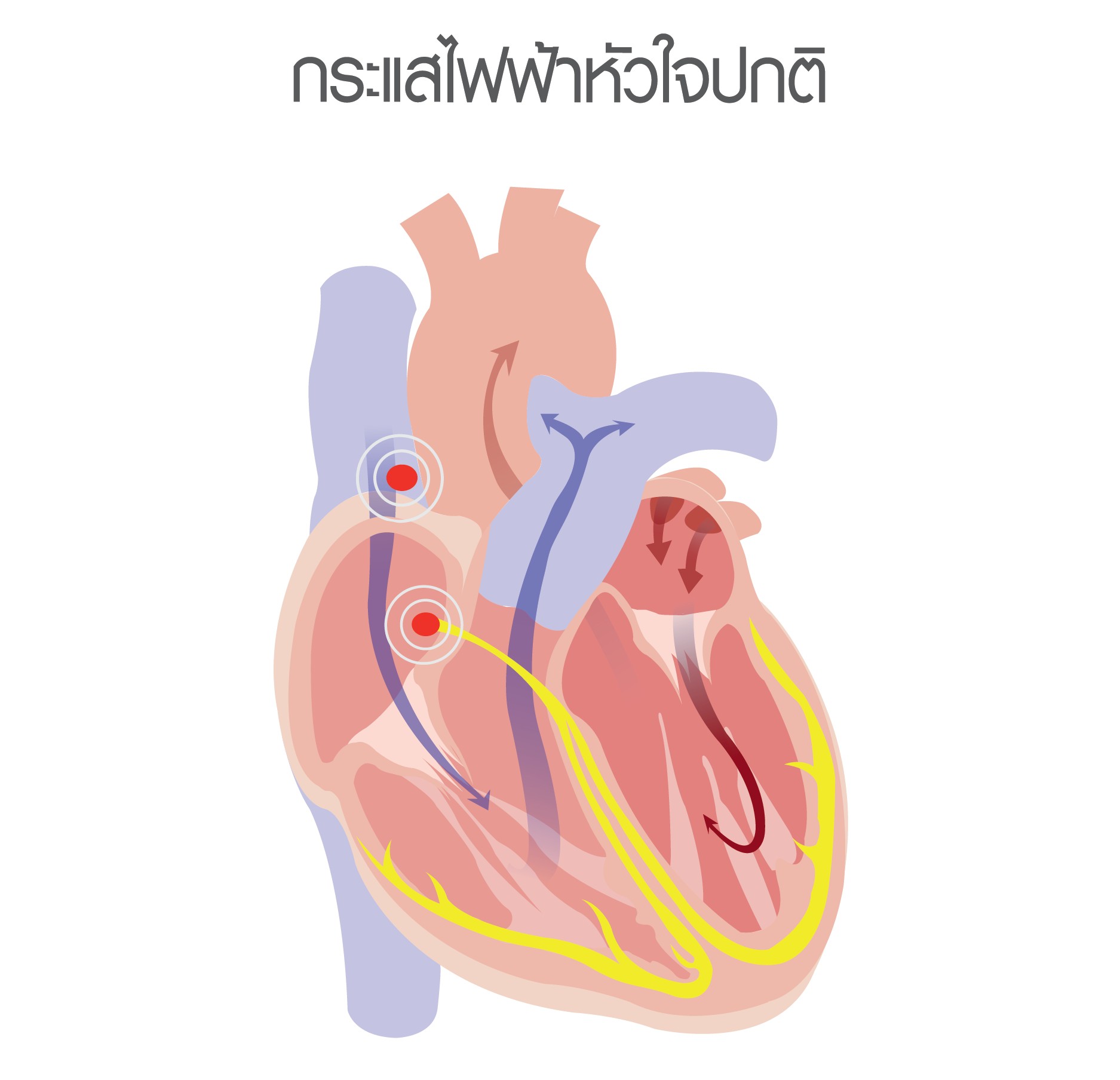 โรคหัวใจ