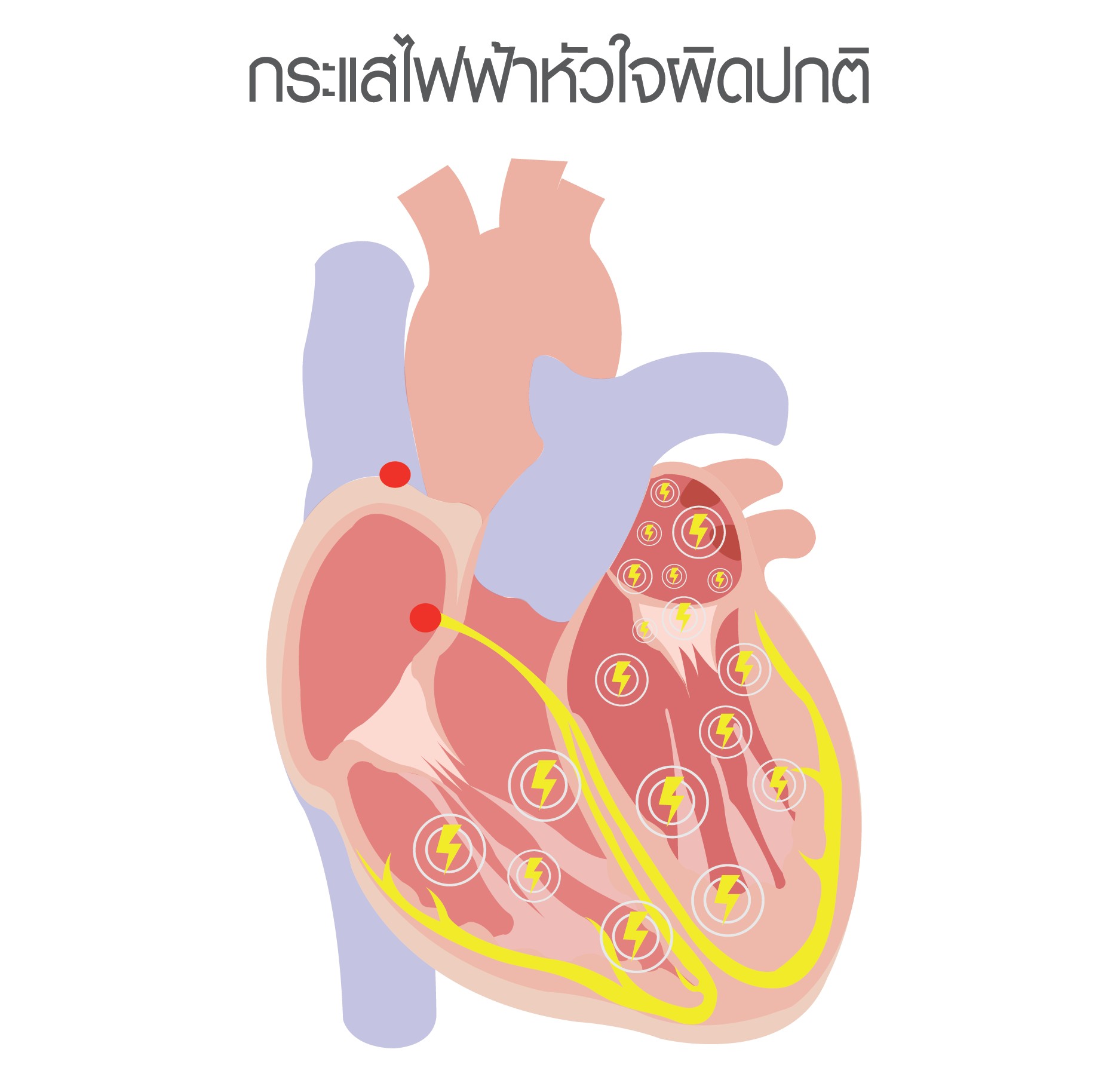 โรคหัวใจ