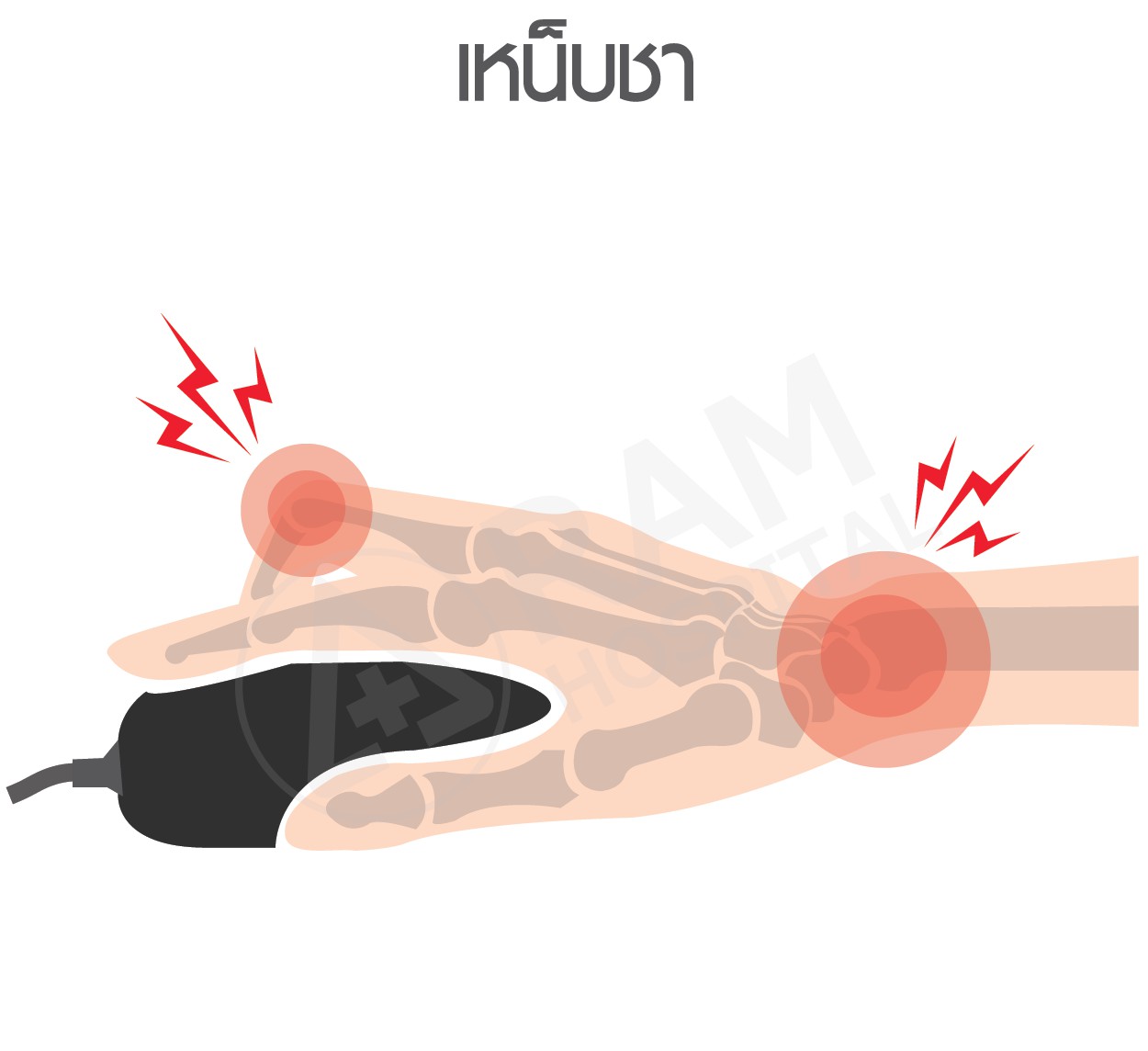 ออฟฟิศซินโดรม