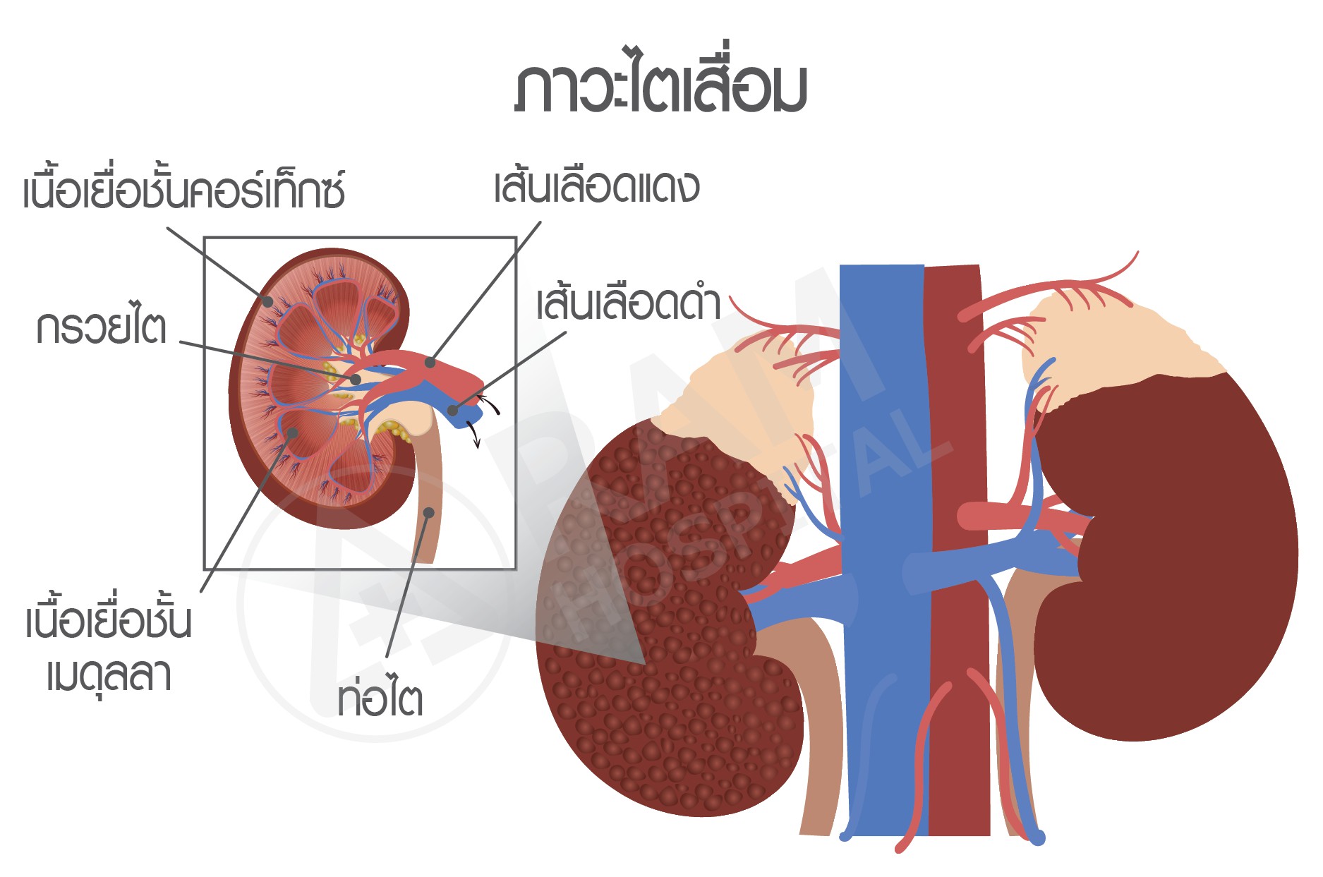 โรคเบาหวาน