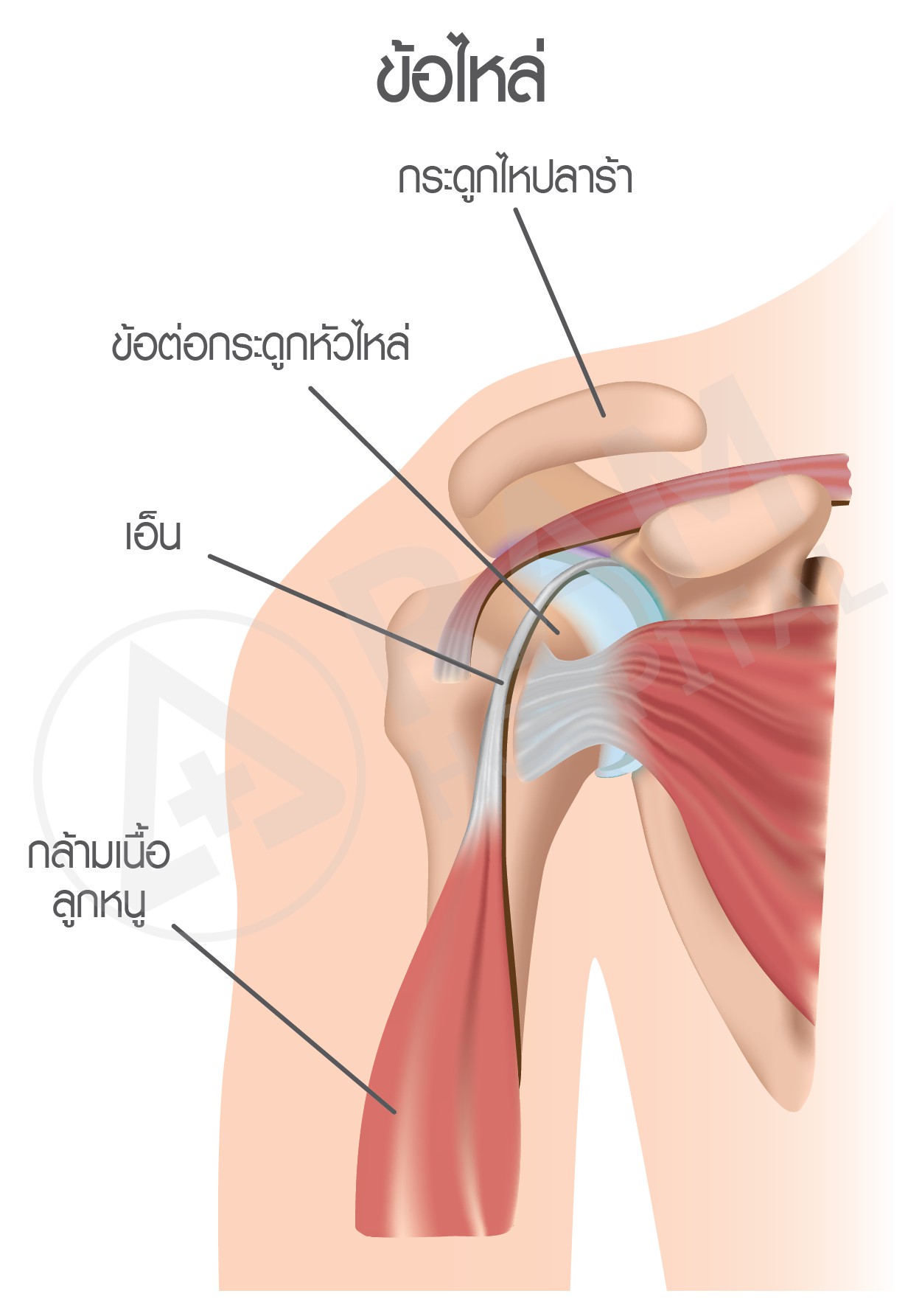 ผ่าตัดหัวไหล่ส่องกล้อง