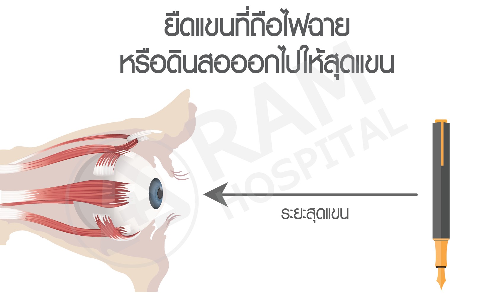 กล้ามเนื้อตาล้า