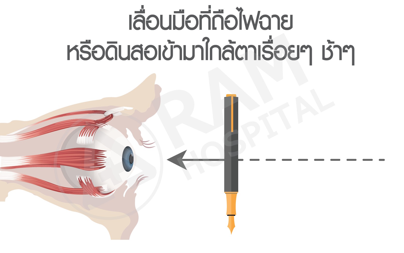 กล้ามเนื้อตาล้า