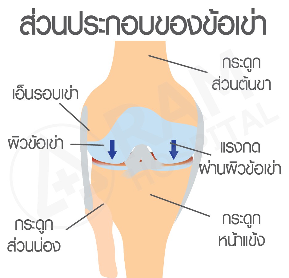 โรคข้อเข่าเสื่อม