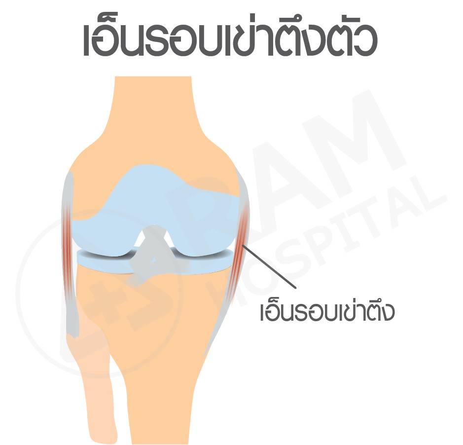 โรคข้อเข่าเสื่อม