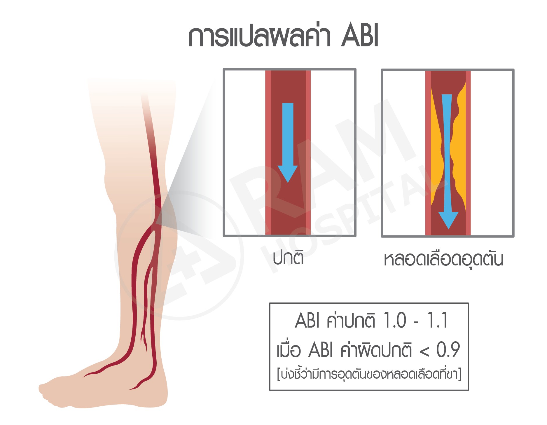 ตรวจ abi