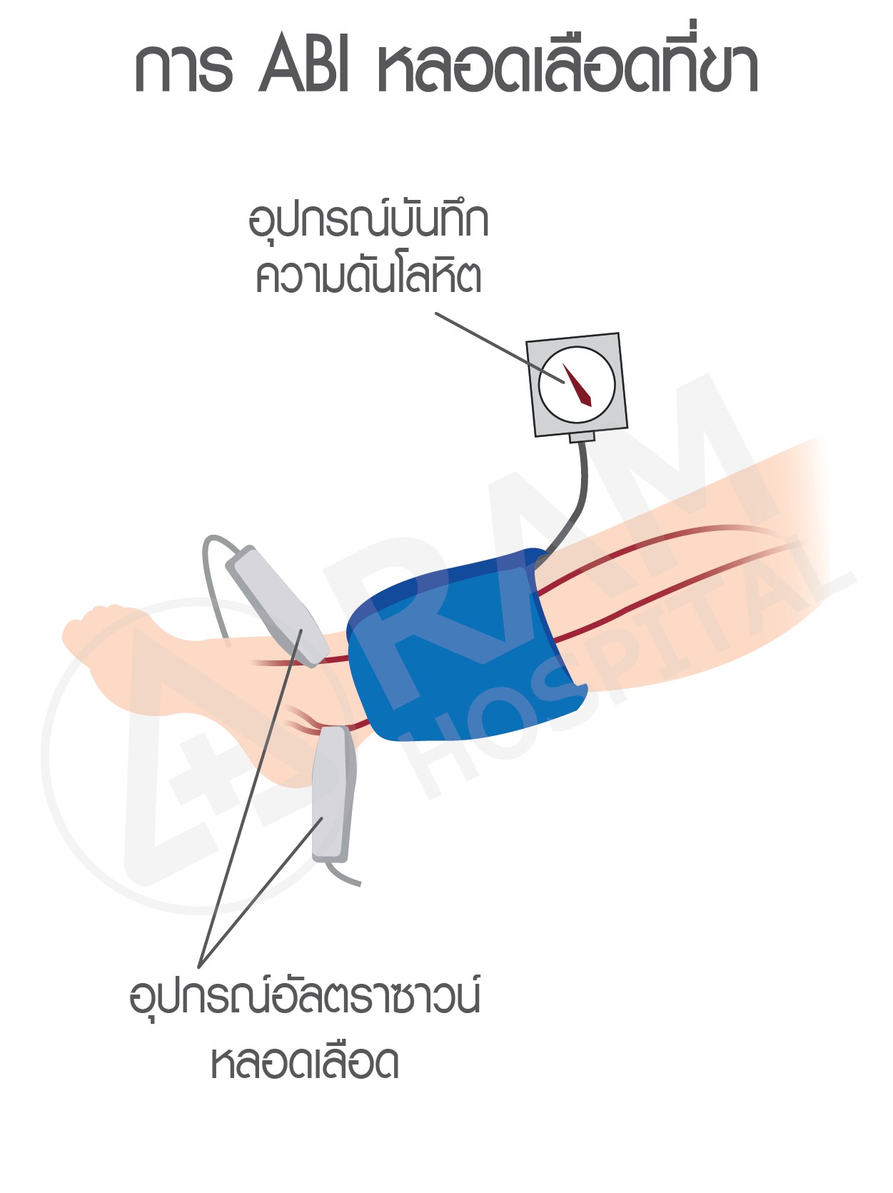 ตรวจ abi