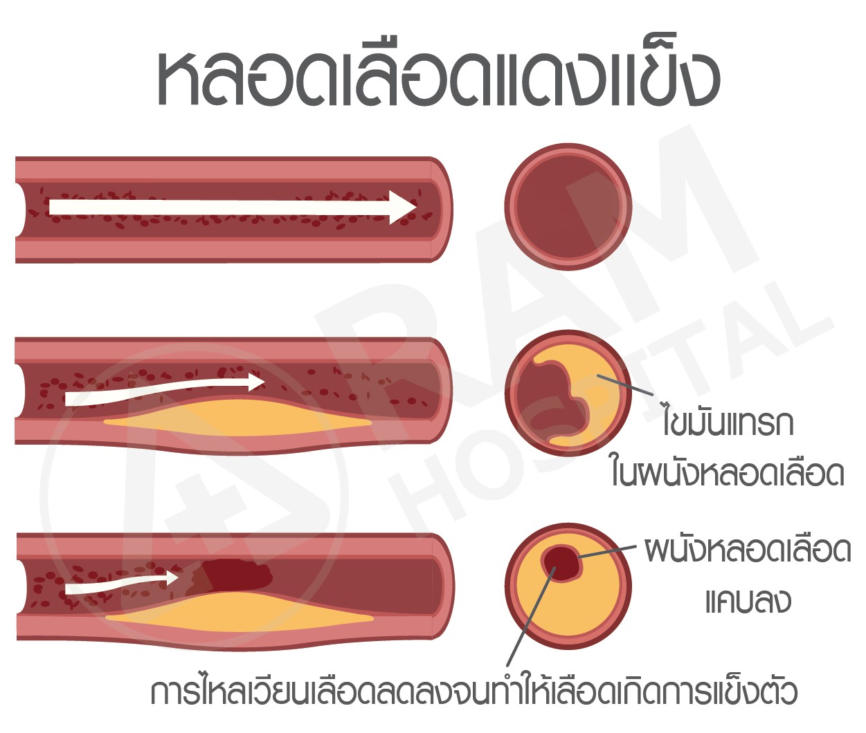 อาหาร ไขมันสูง