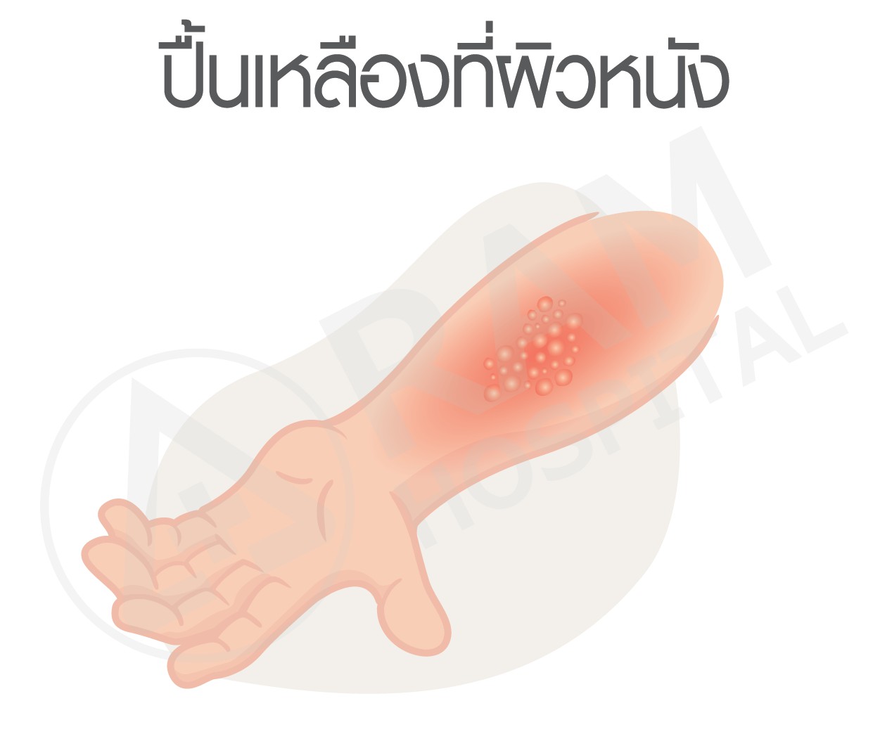อาหาร ไขมันสูง