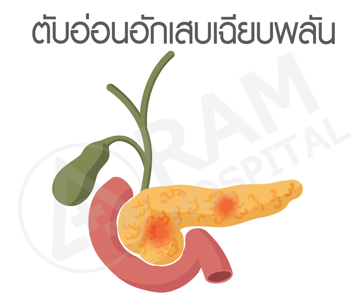 อาหาร ไขมันสูง