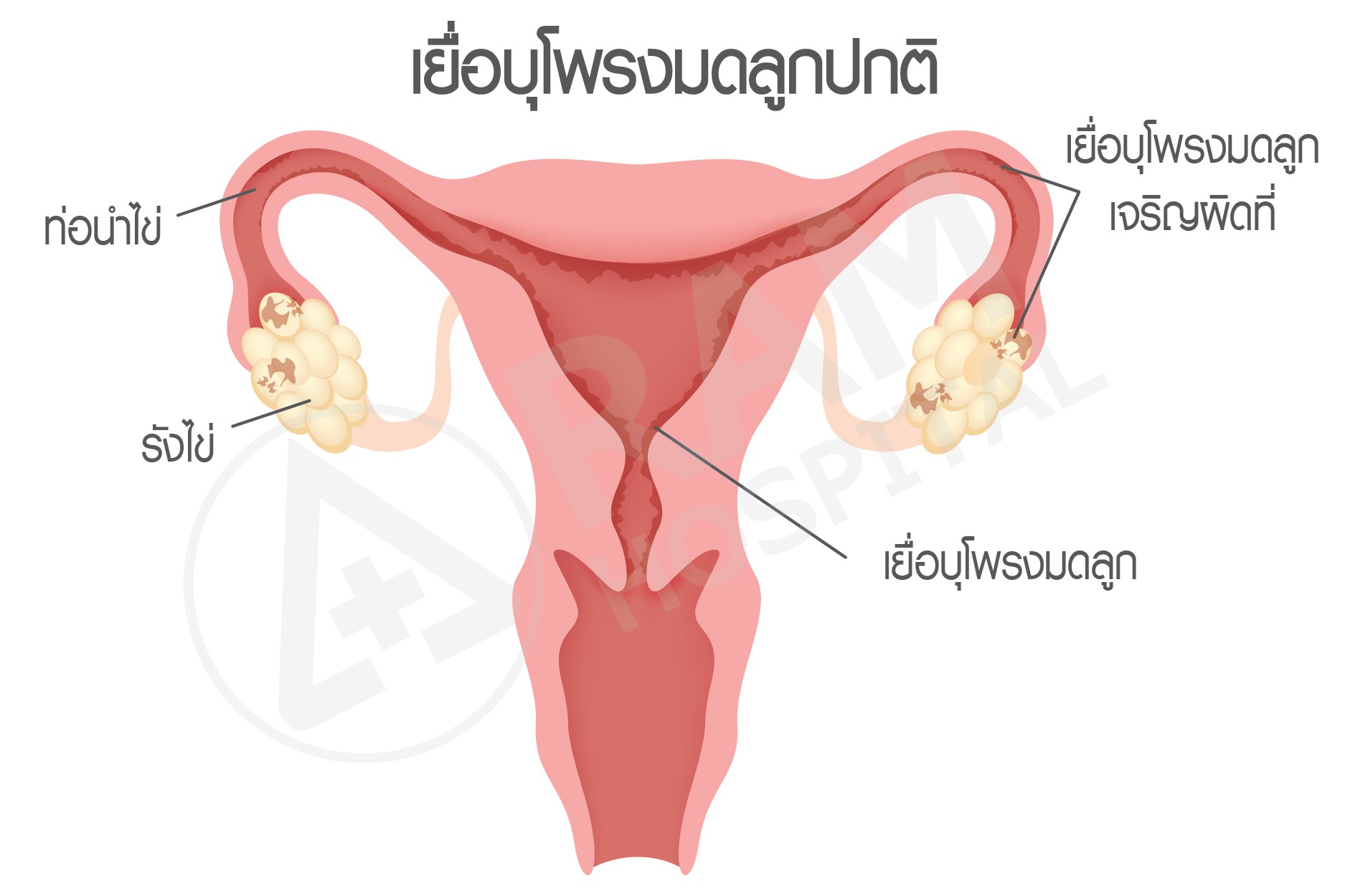 ช็อกโกแลตซีส