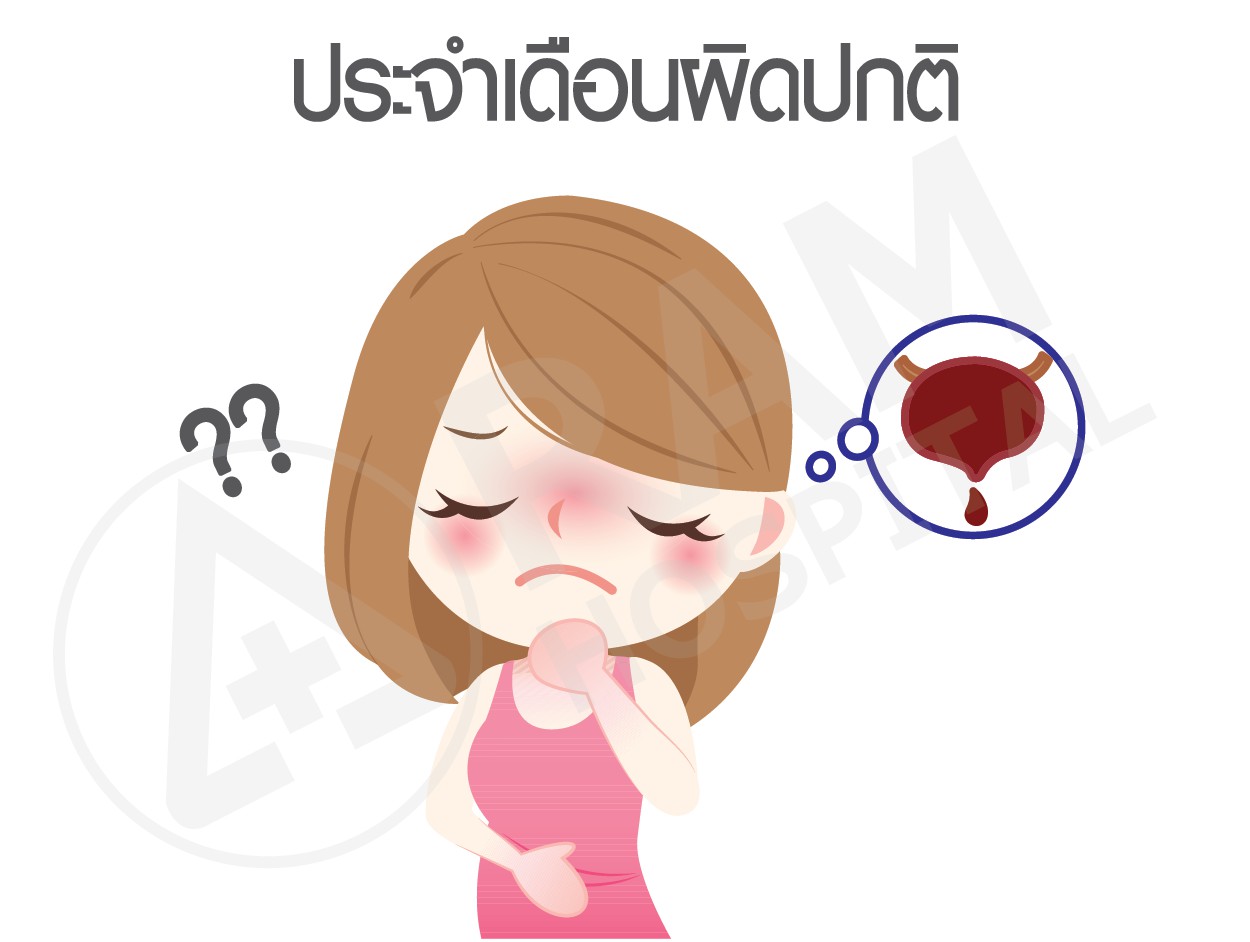 ช็อกโกแลตซีส