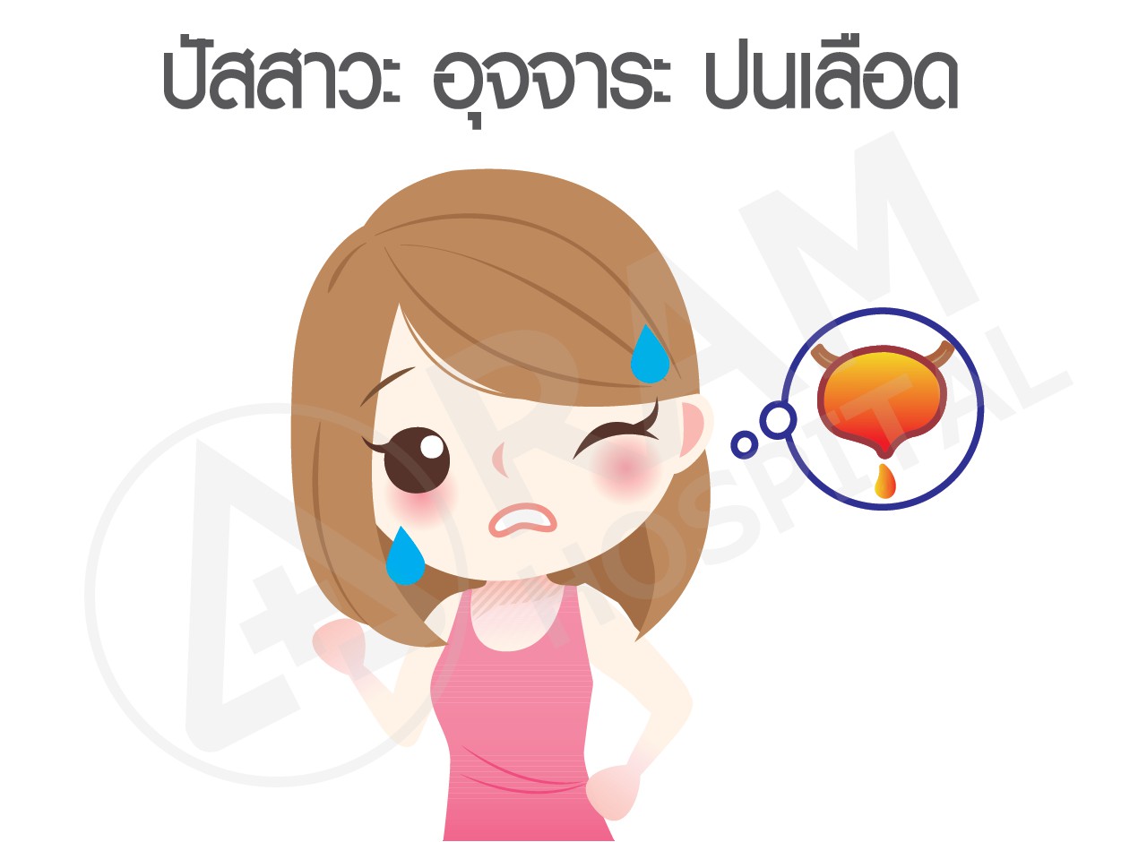 ช็อกโกแลตซีส
