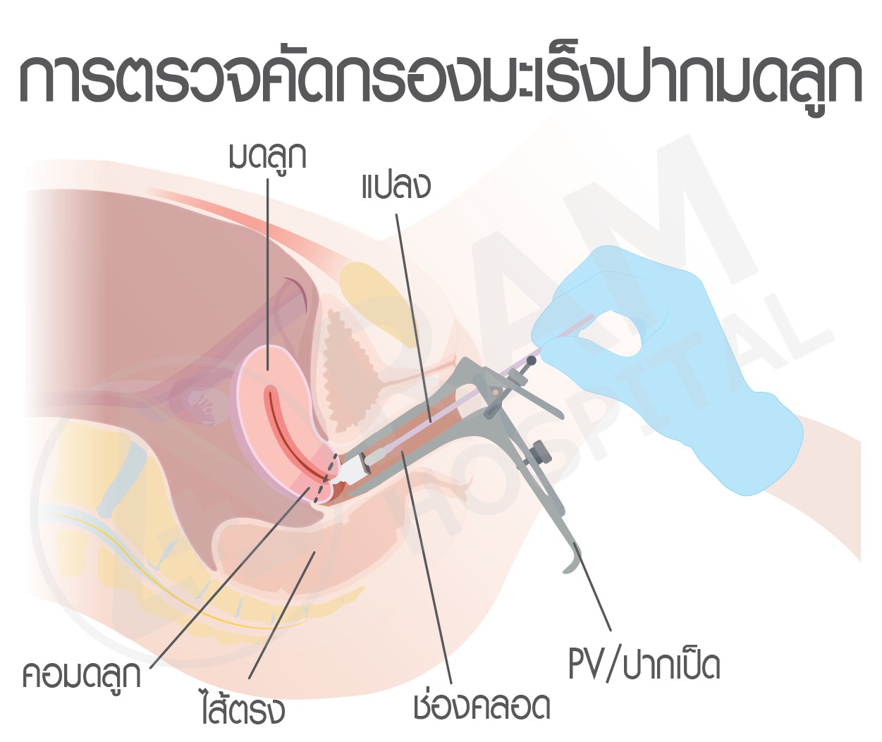 วัคซีน HPV