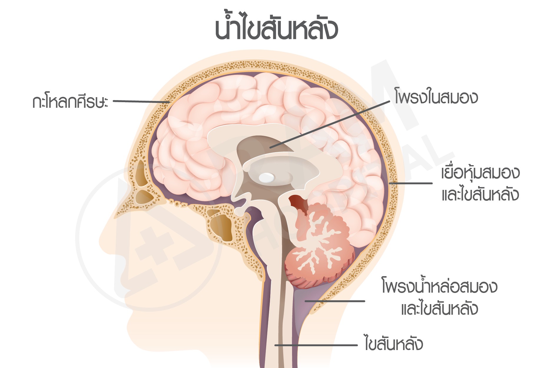 โรคน้ำคั่งในโพรงสมอง