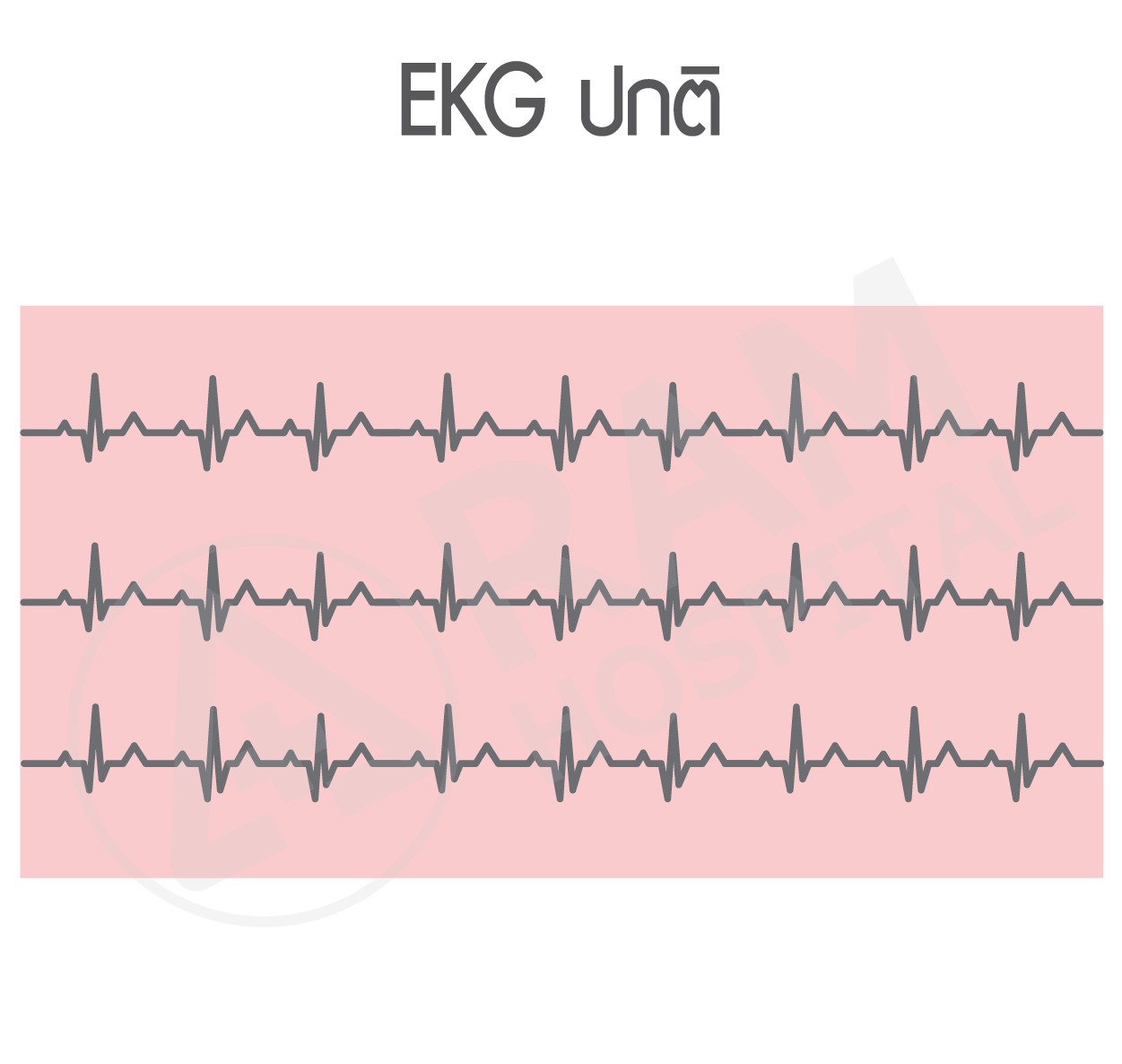 ตรวจคลื่นไฟฟ้าหัวใจ