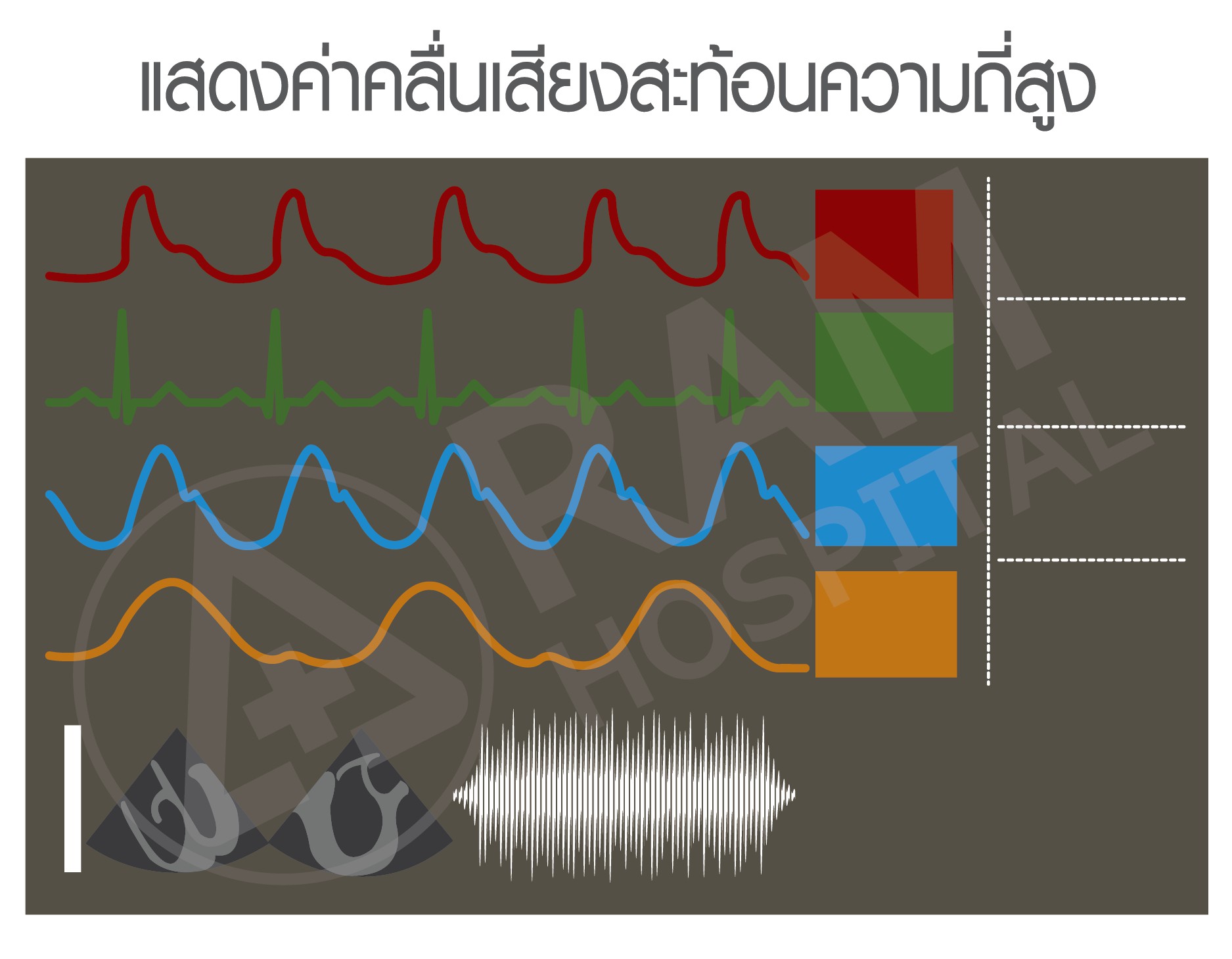 ตรวจคลื่นไฟฟ้าหัวใจ