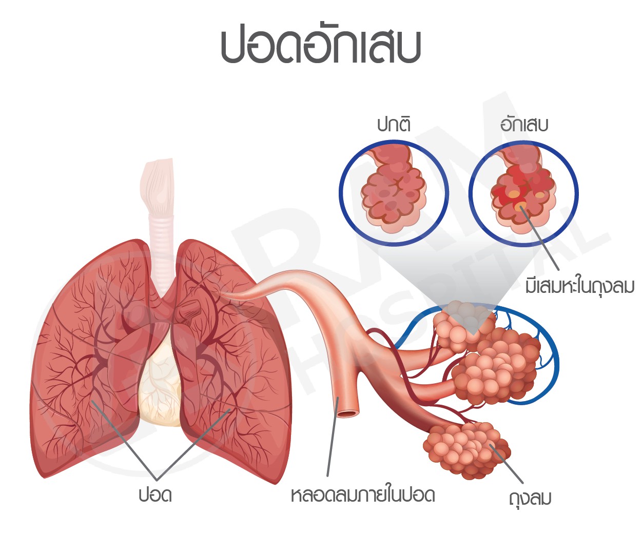 ไข้หวัดใหญ่