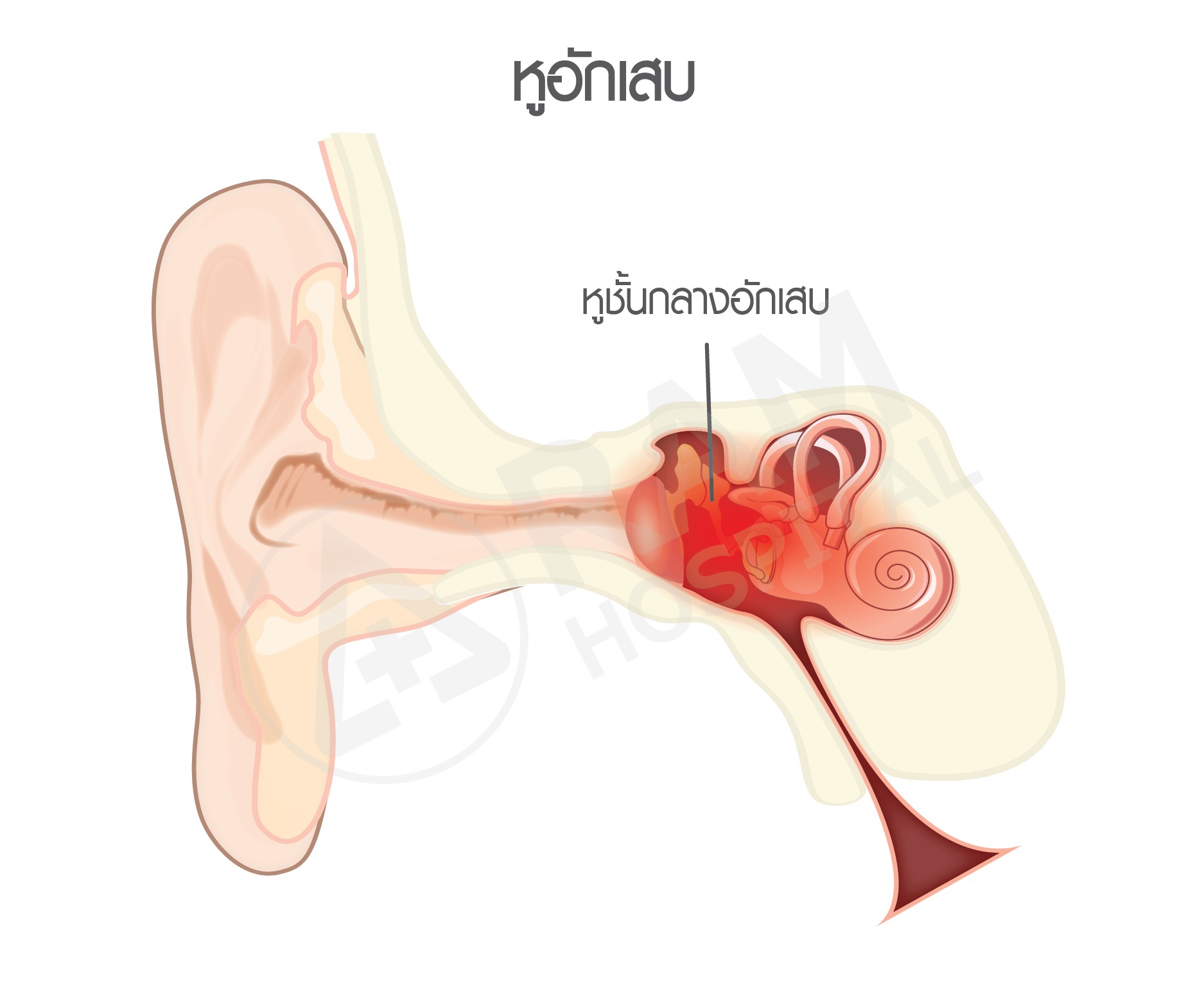 ไข้หวัดใหญ่ เบาหวาน