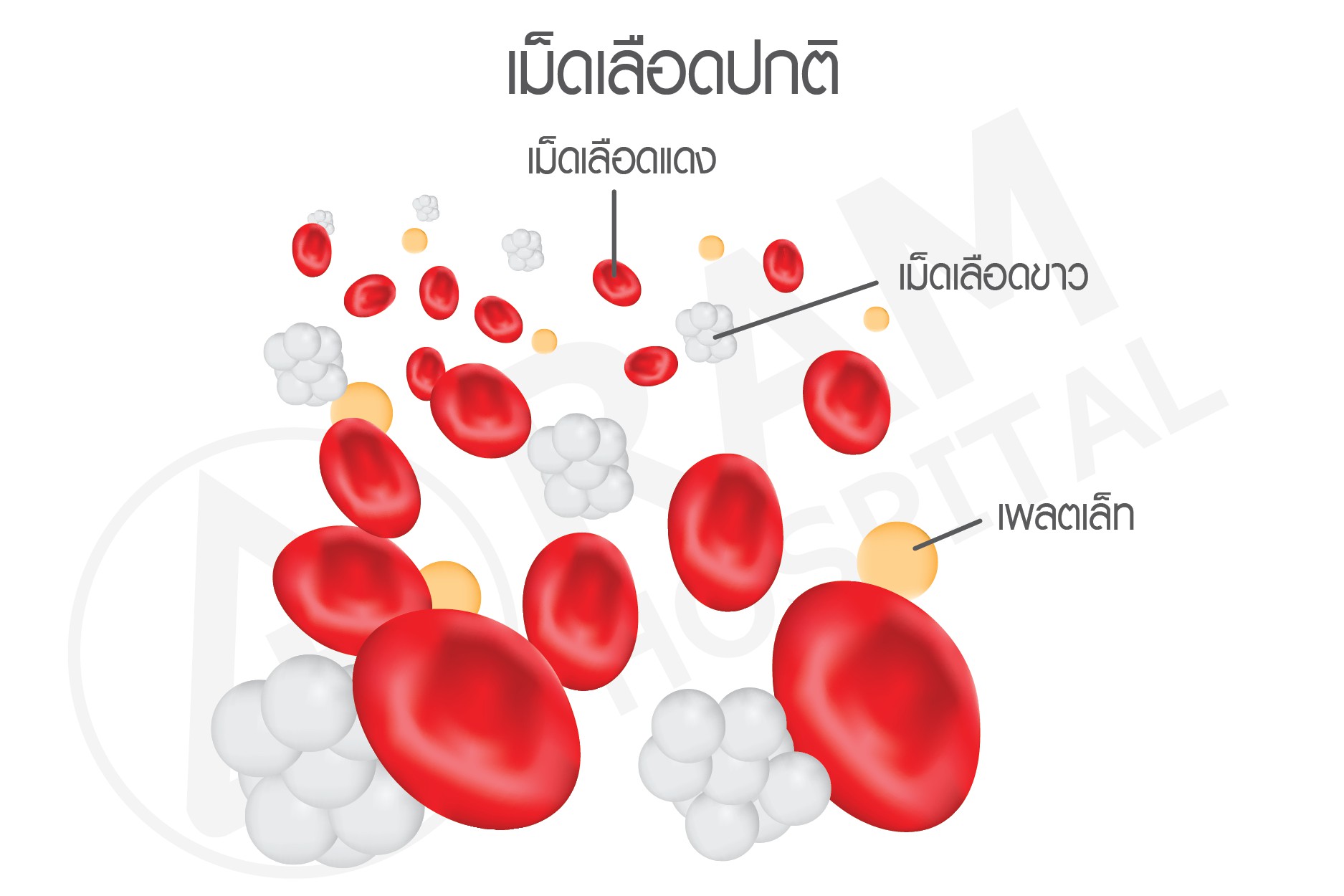 ธาลัสซ๊เมีย