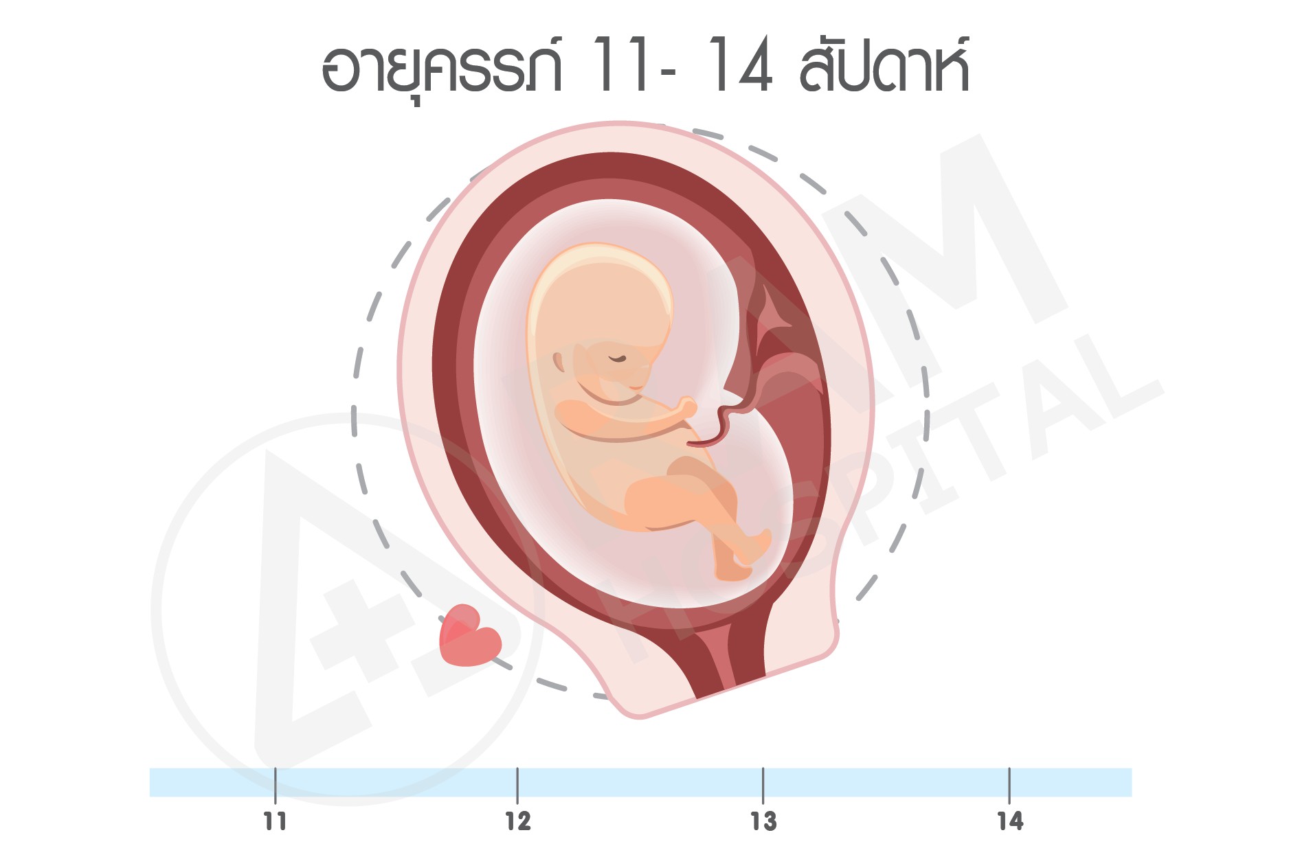 อัลตราซาว อายุครรภ์
