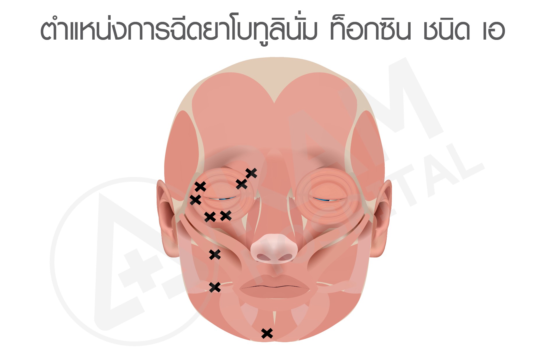 ใบหน้ากระตุกครึ่งซีก
