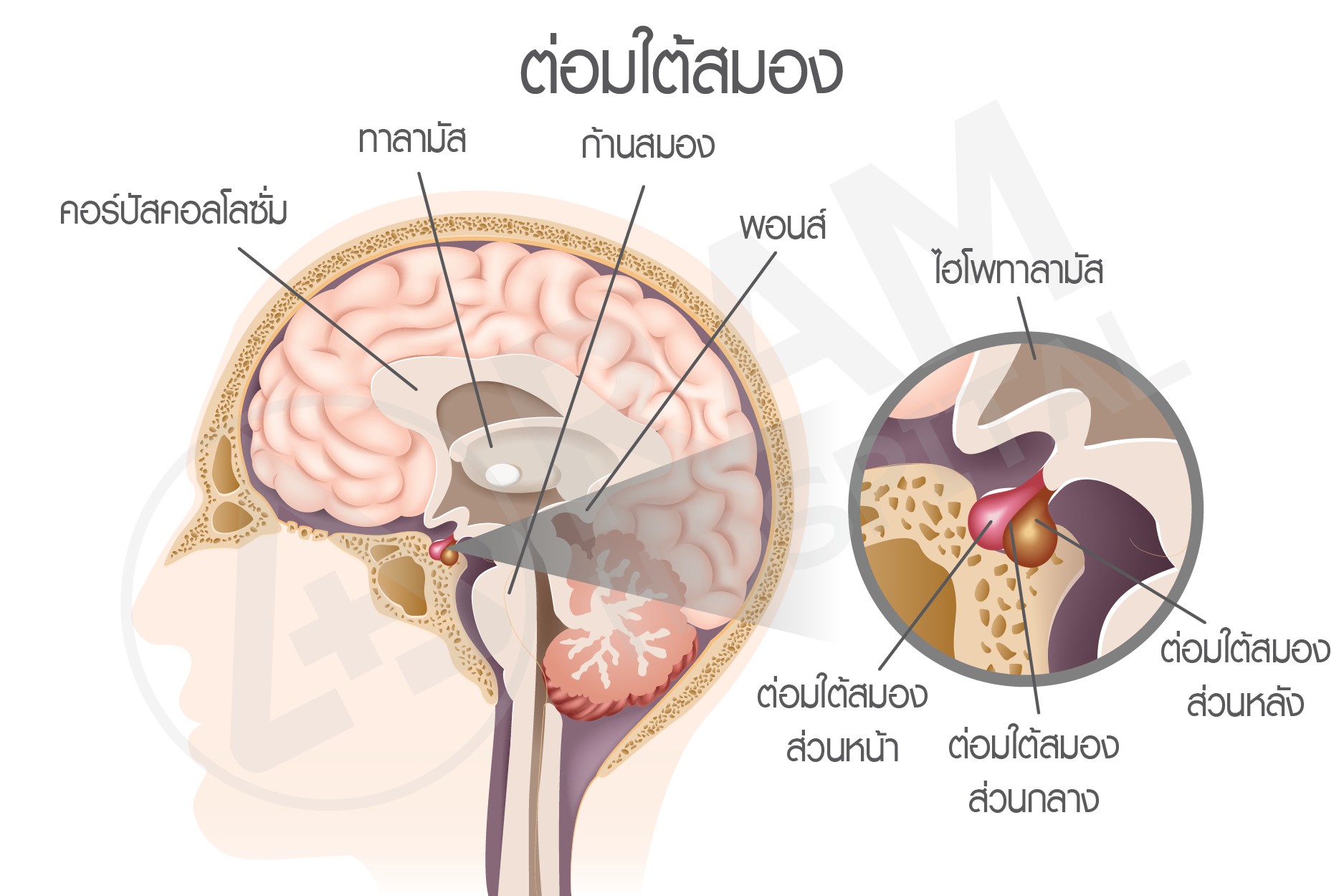 เนื้องอกต่อมใต้สมอง