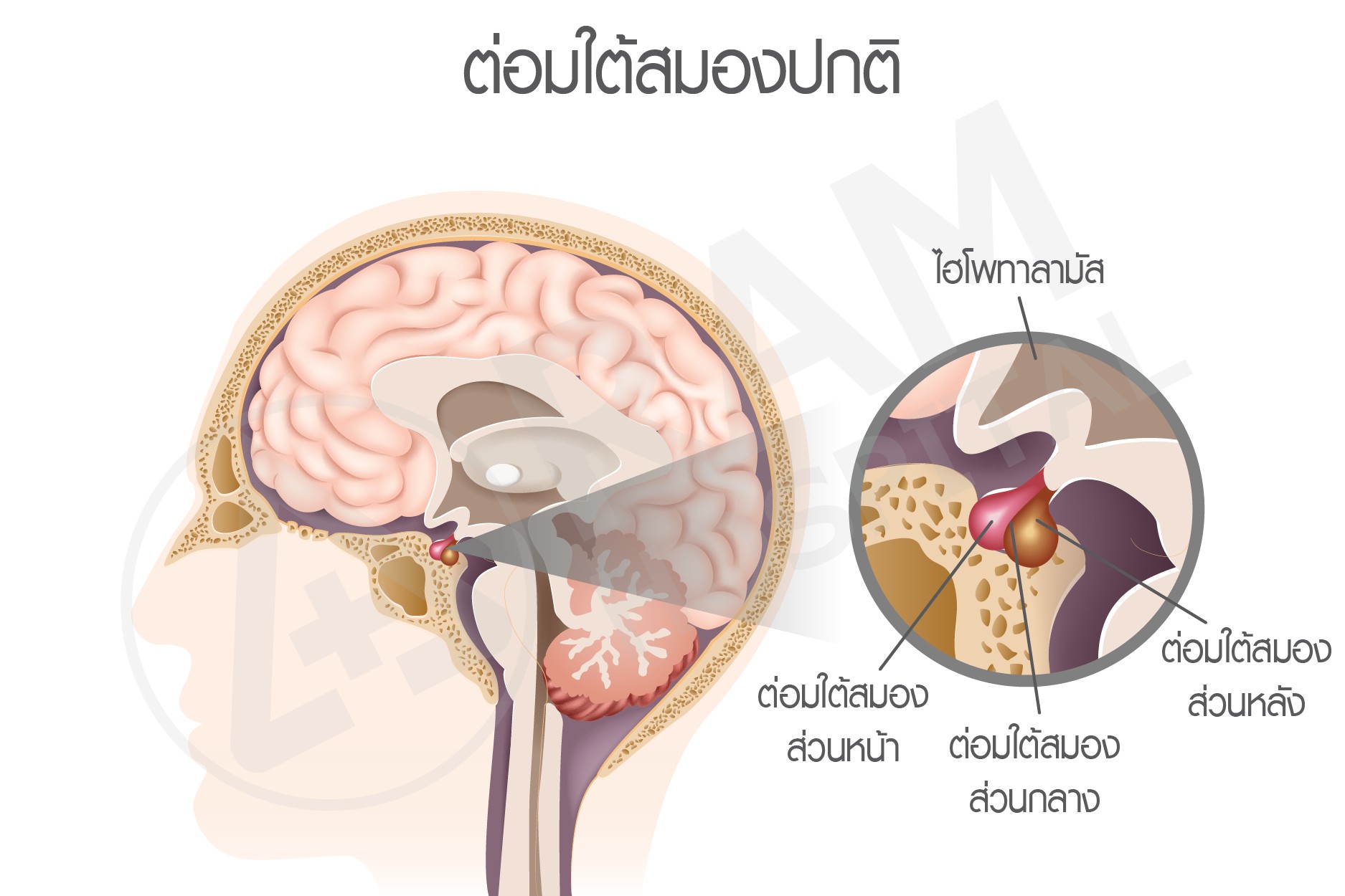 เนื้องอกต่อมใต้สมอง