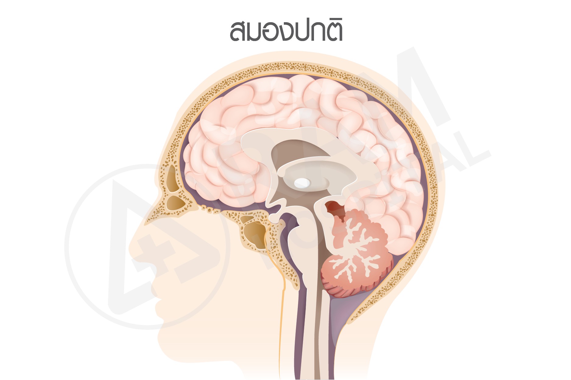 เนื้องอกมะเร็งสมอง