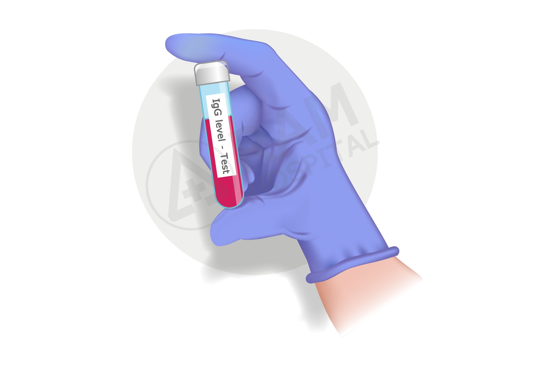 ตรวจหาภูมิต้านทานต่อเชื้อ SARS-CoV2