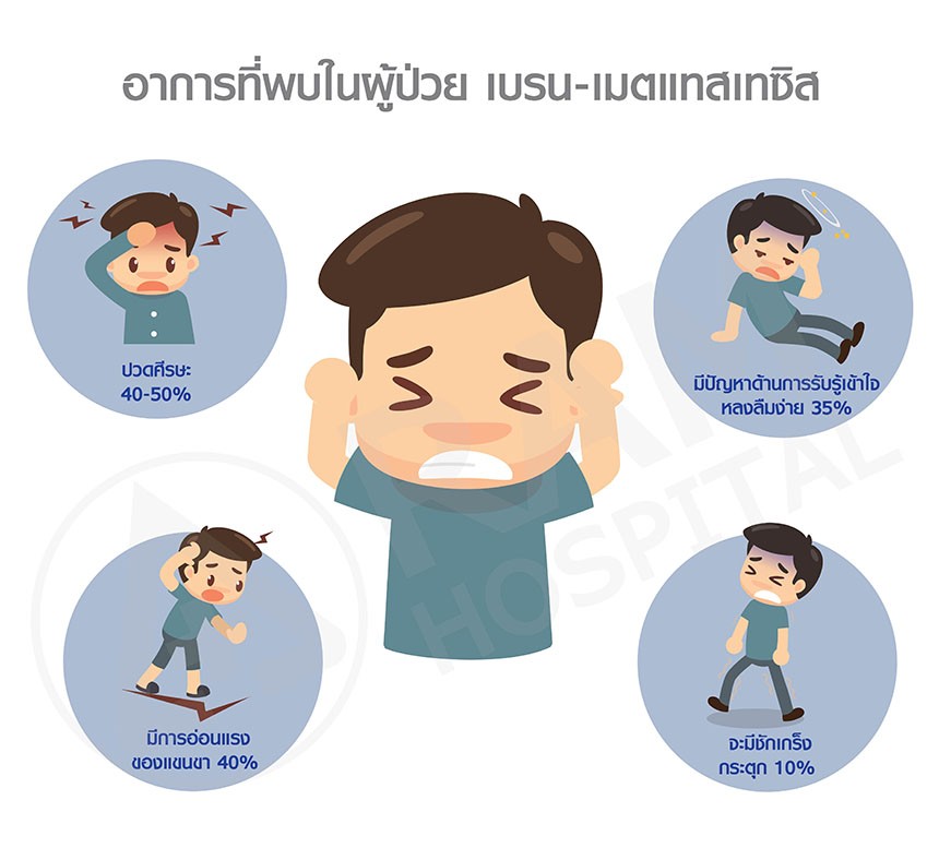 เนื้องอกสมองจากมะเร็ง