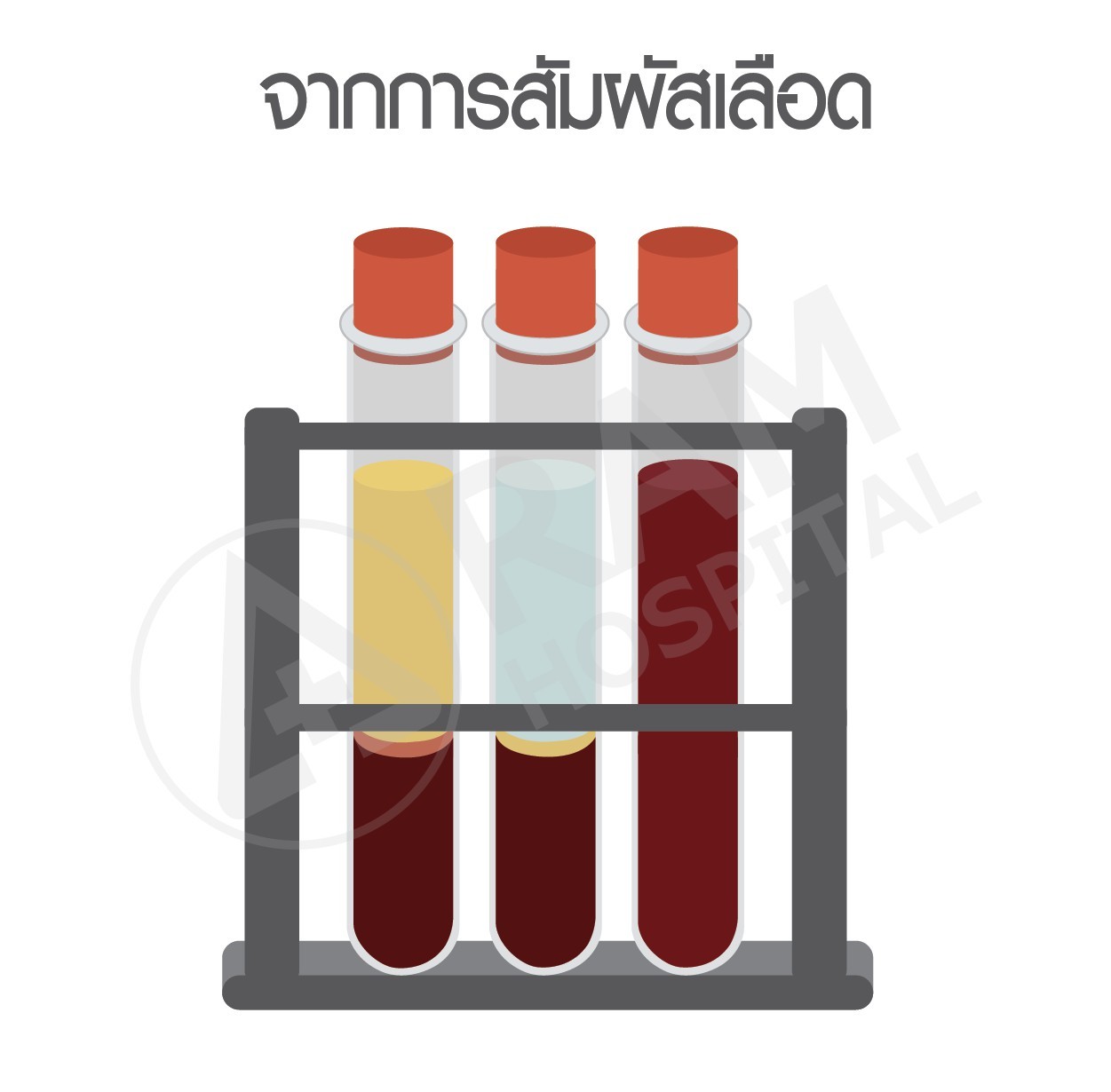 โรคไวรัสตับอักเสบบี