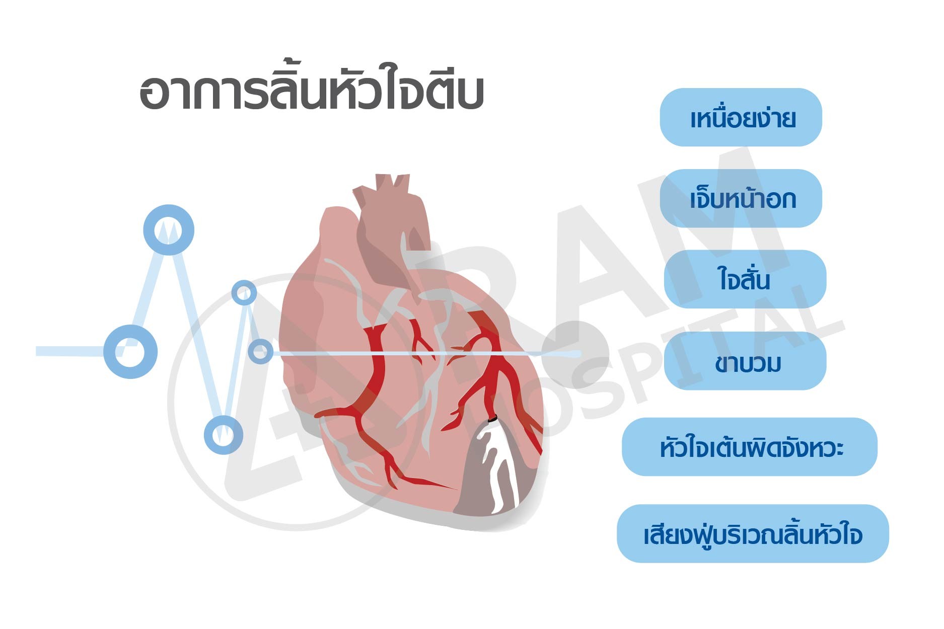 ลิ้นหัวใจตีบ รักษา ไม่ต้องผ่าตัด