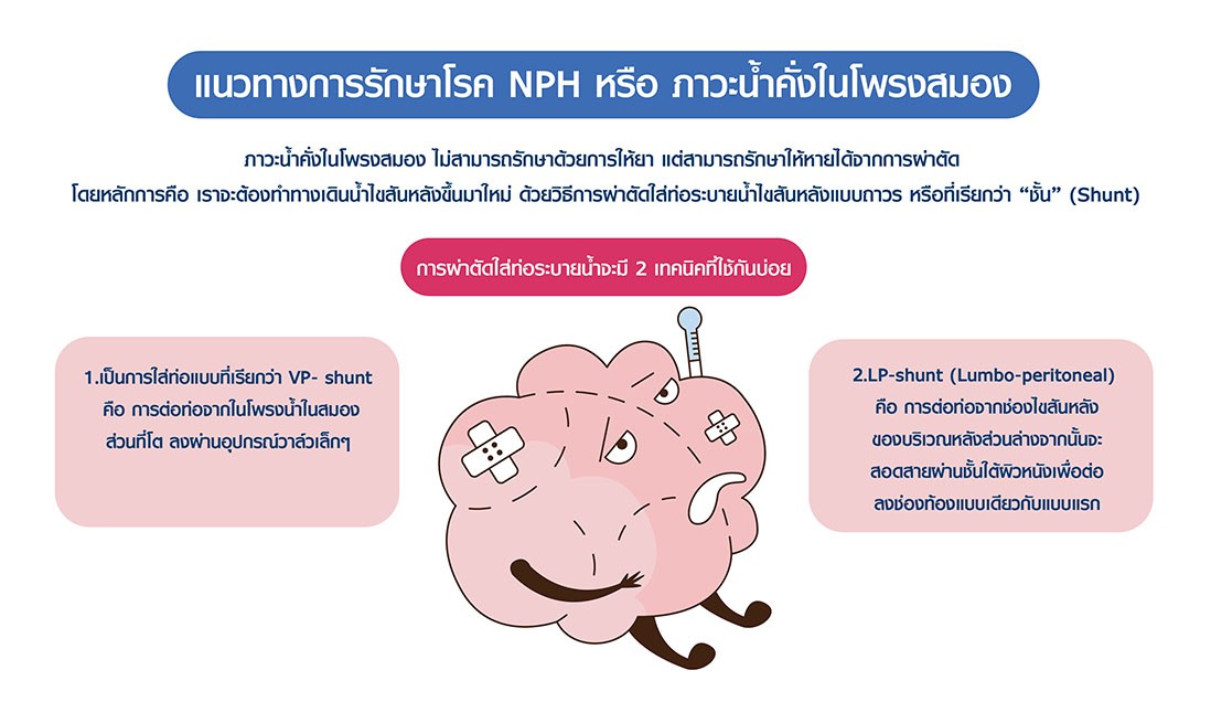โรคน้ำคั่งในโพรงสมอง