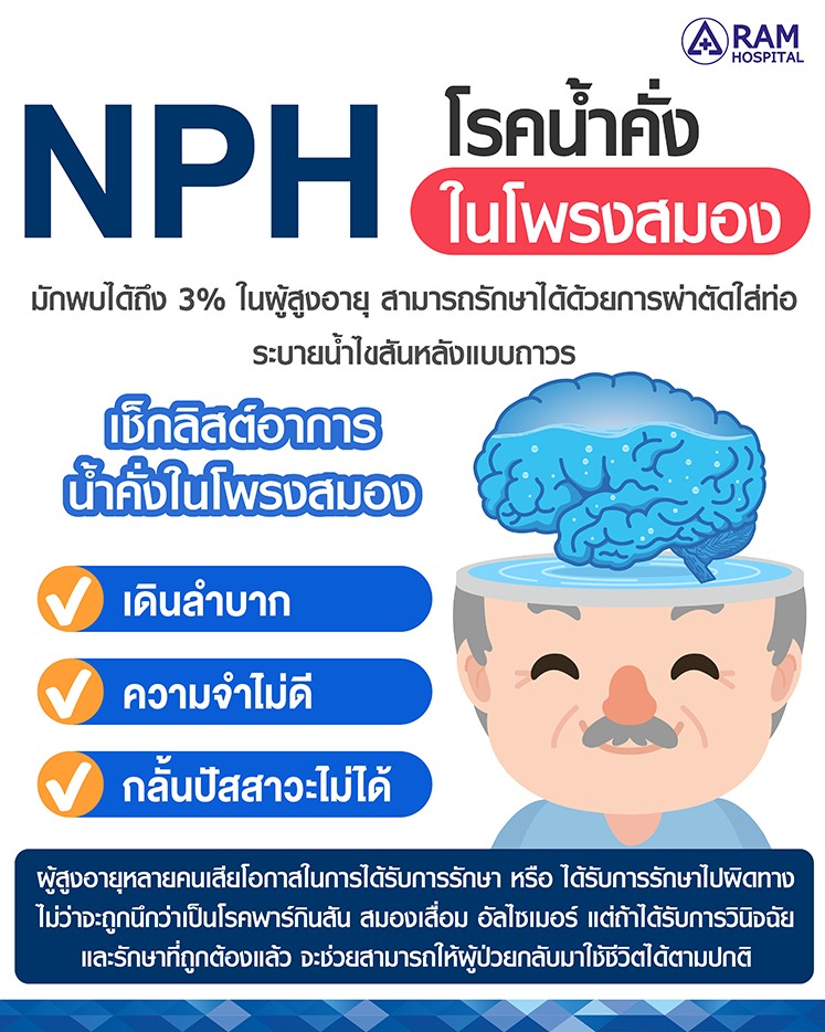 โรคน้ำคั่งในโพรงสมอง
