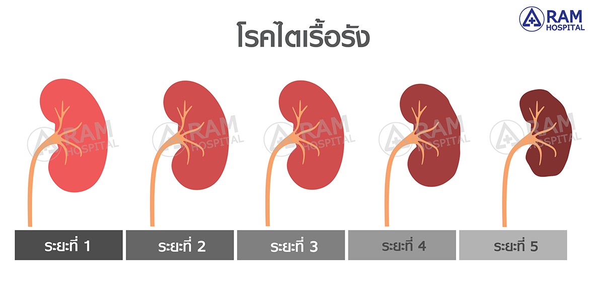 ไตวายเรื้อรัง