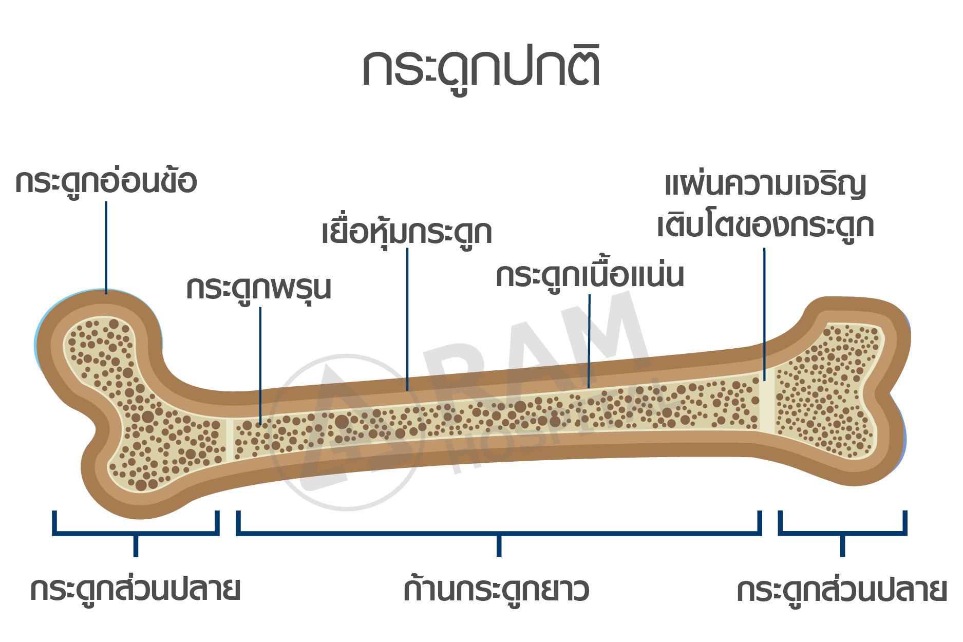 กระดูกพรุน