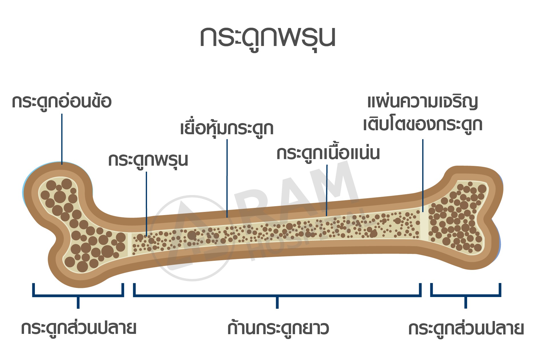 กระดูกพรุน