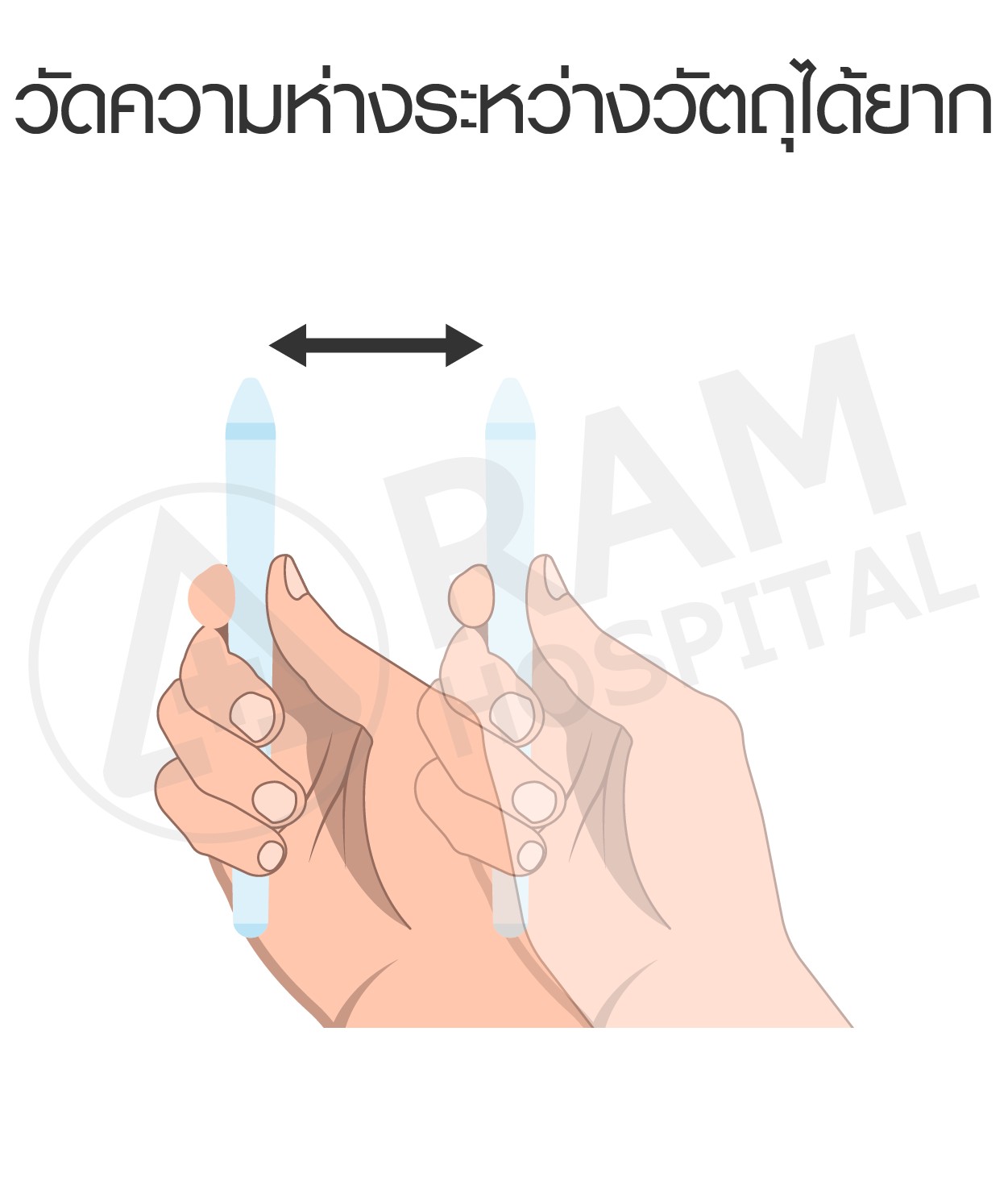 โรคตาขี้เกียจ