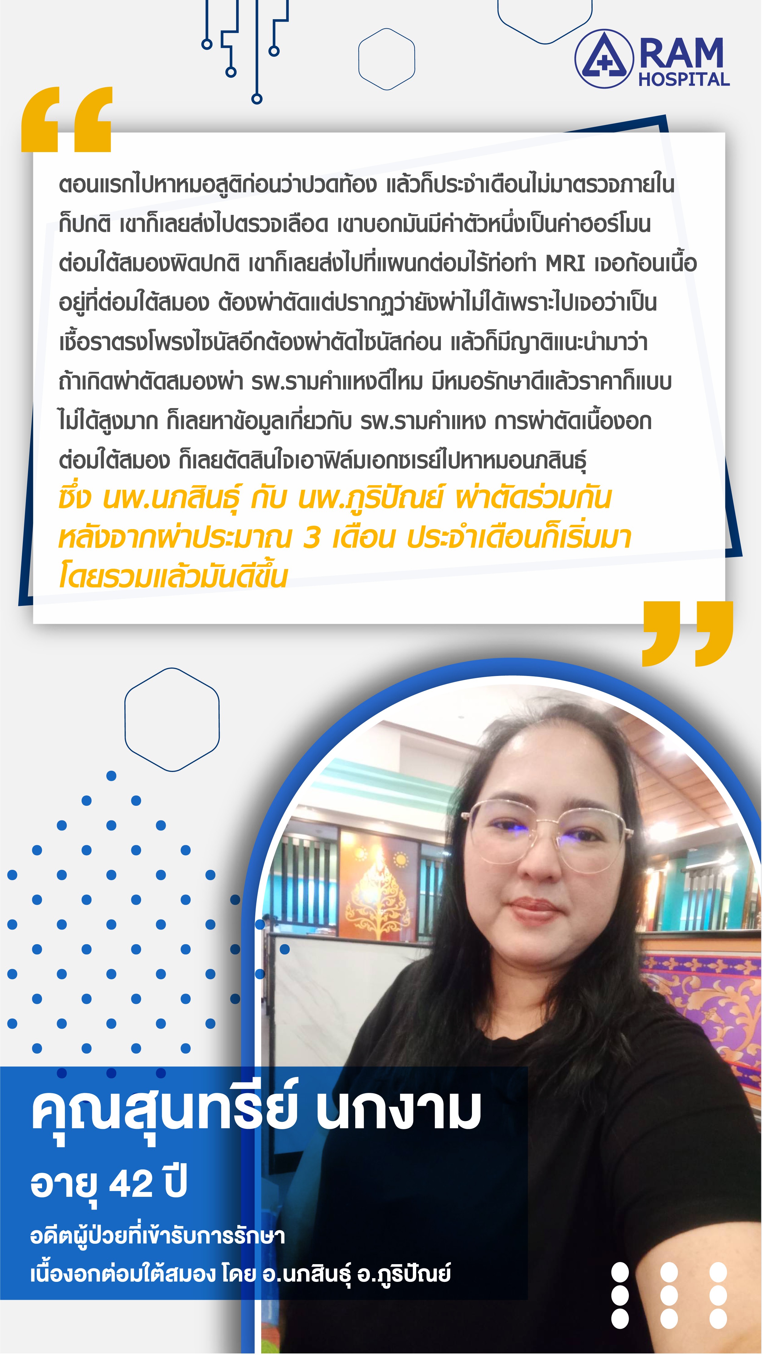 เนื้องอกต่อมใต้สมอง