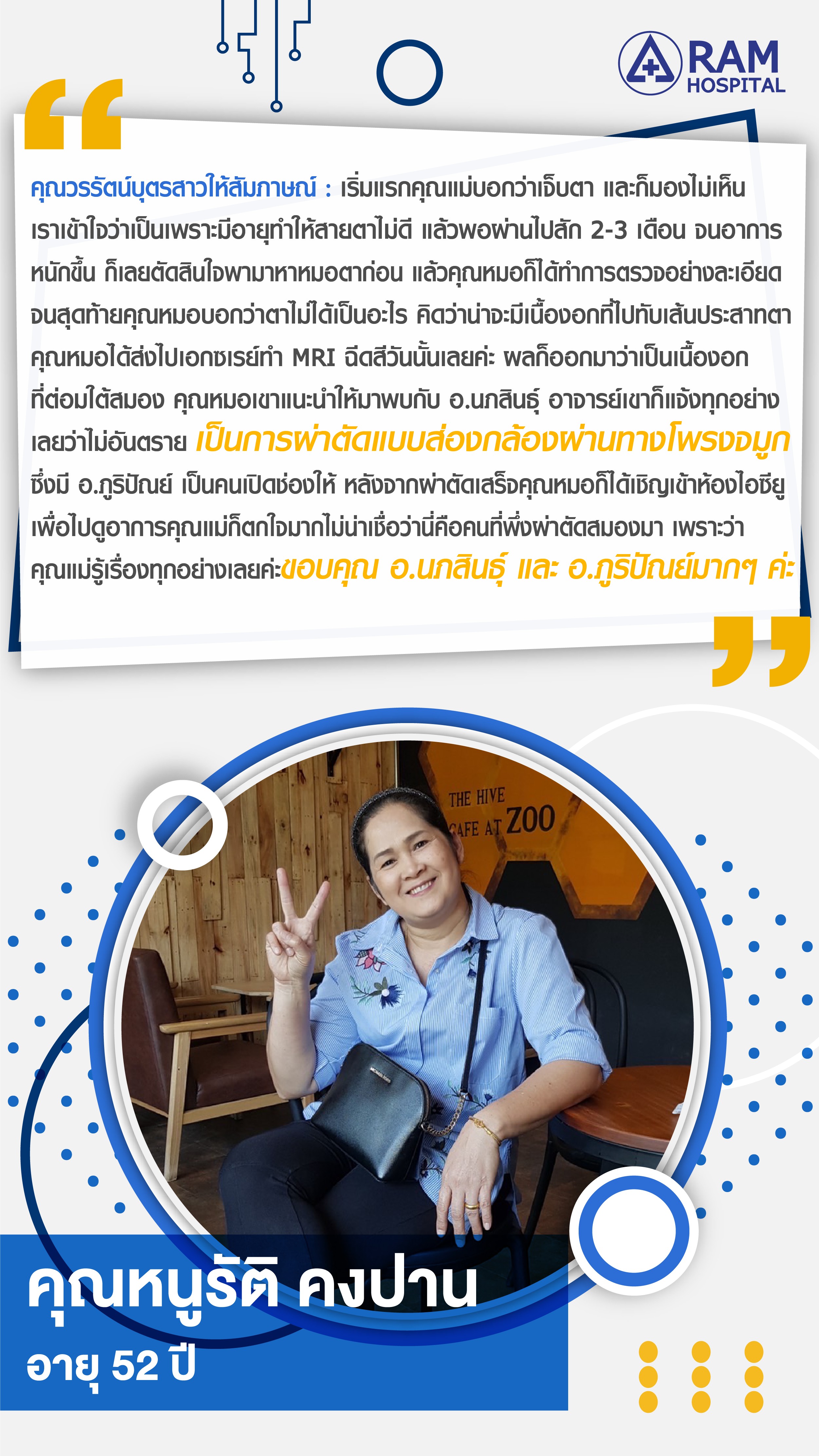 เนื้องอกต่อมใต้สมอง
