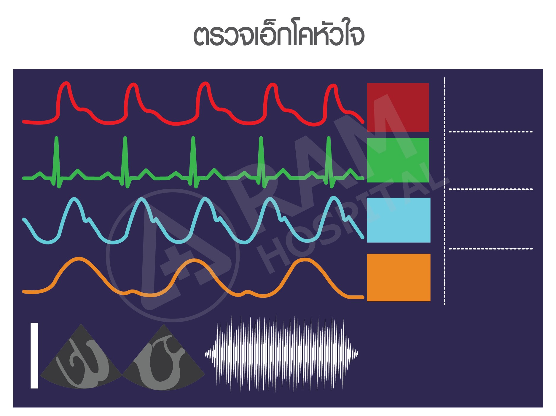 ความดันสูง โรคหัวใจ