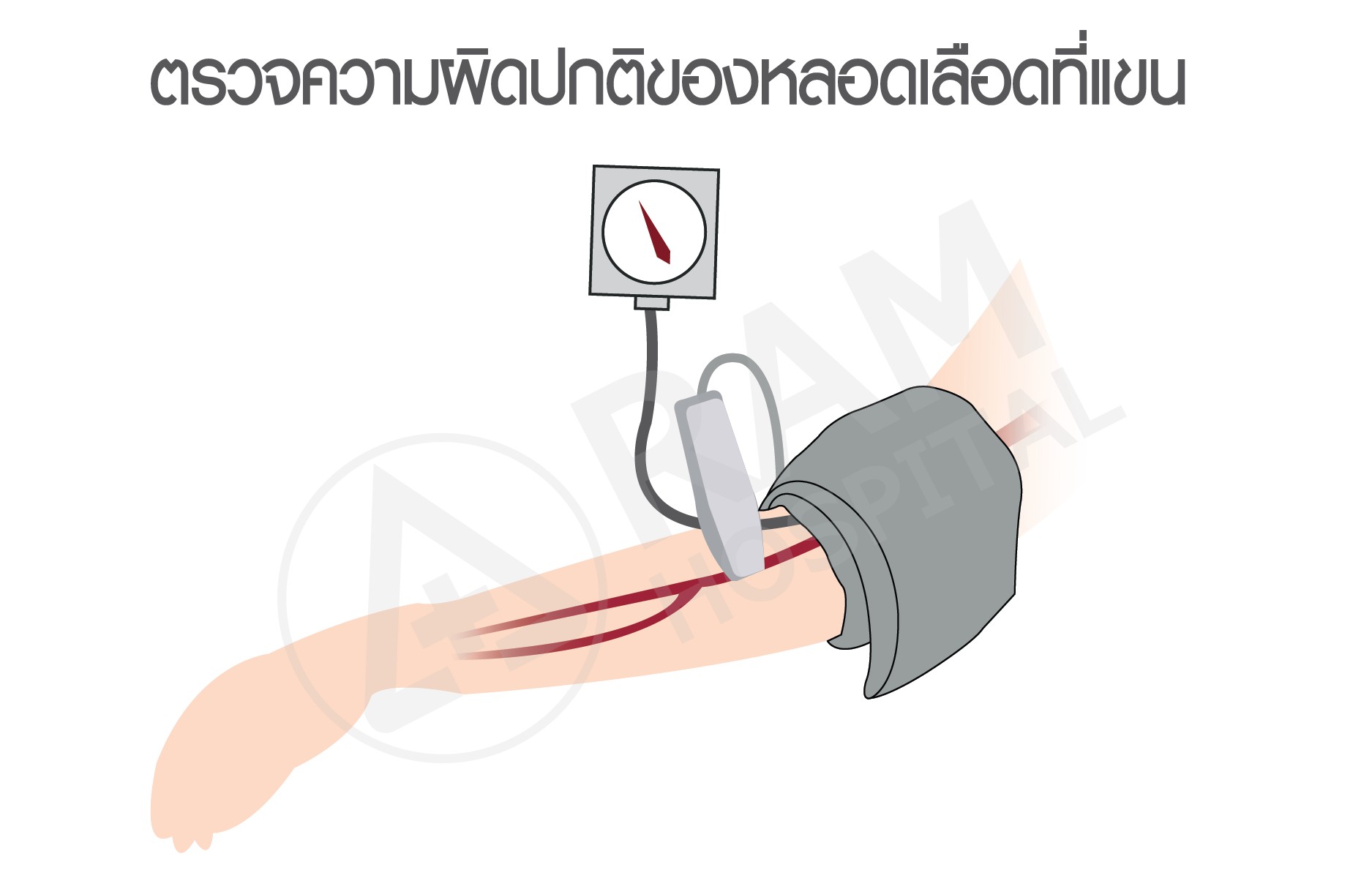 ความดันสูง โรคหัวใจ