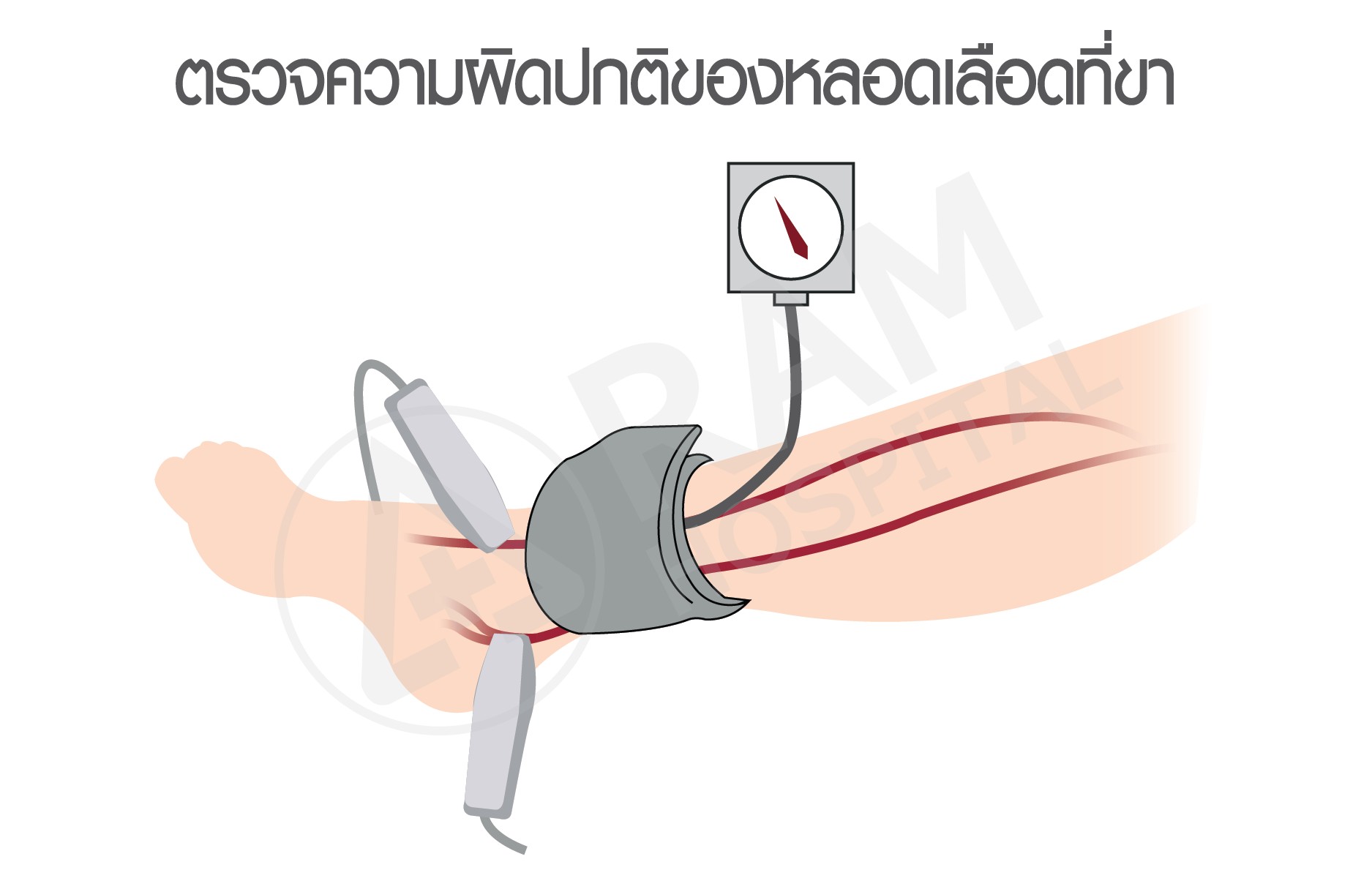 ความดันสูง โรคหัวใจ