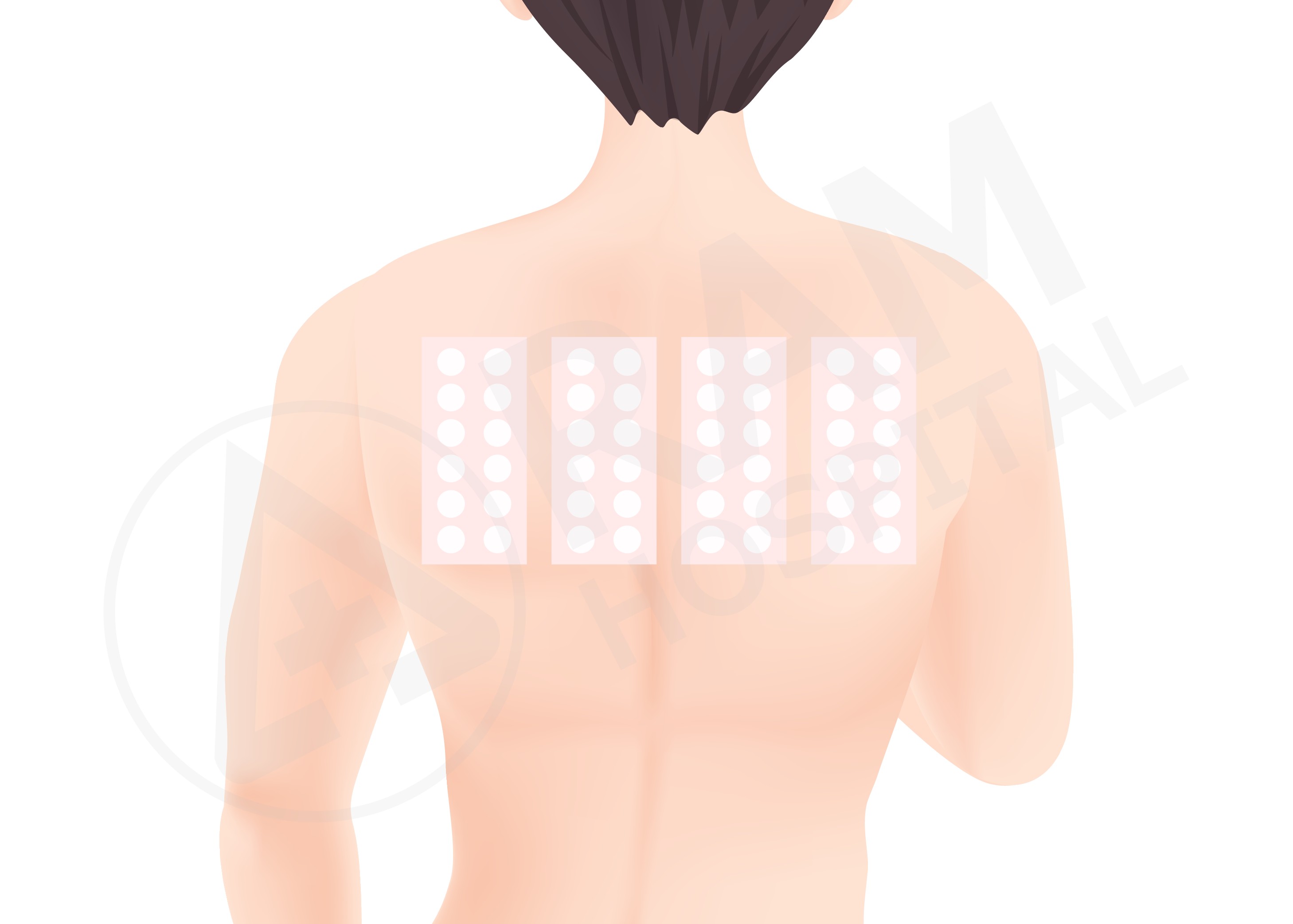 ทดสอบภูมิแพ้ผิวหนัง