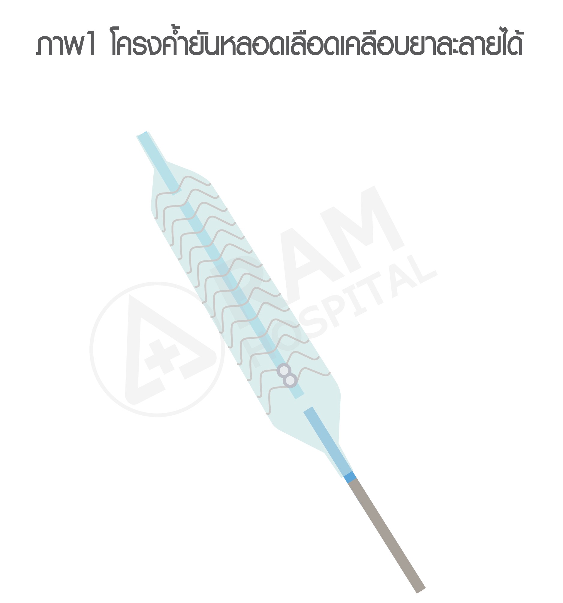 หัวใจตีบ รักษา บอลลูน
